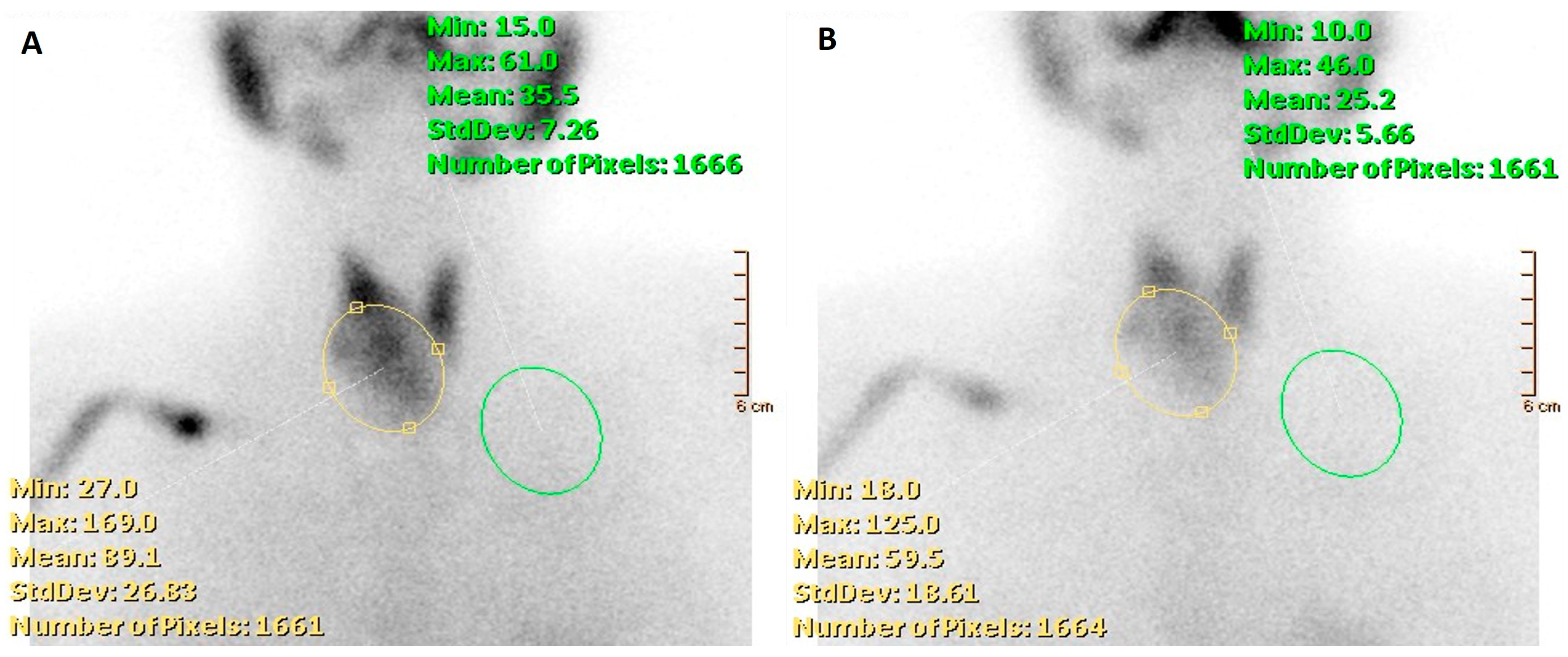 Cancers 16 00311 g005