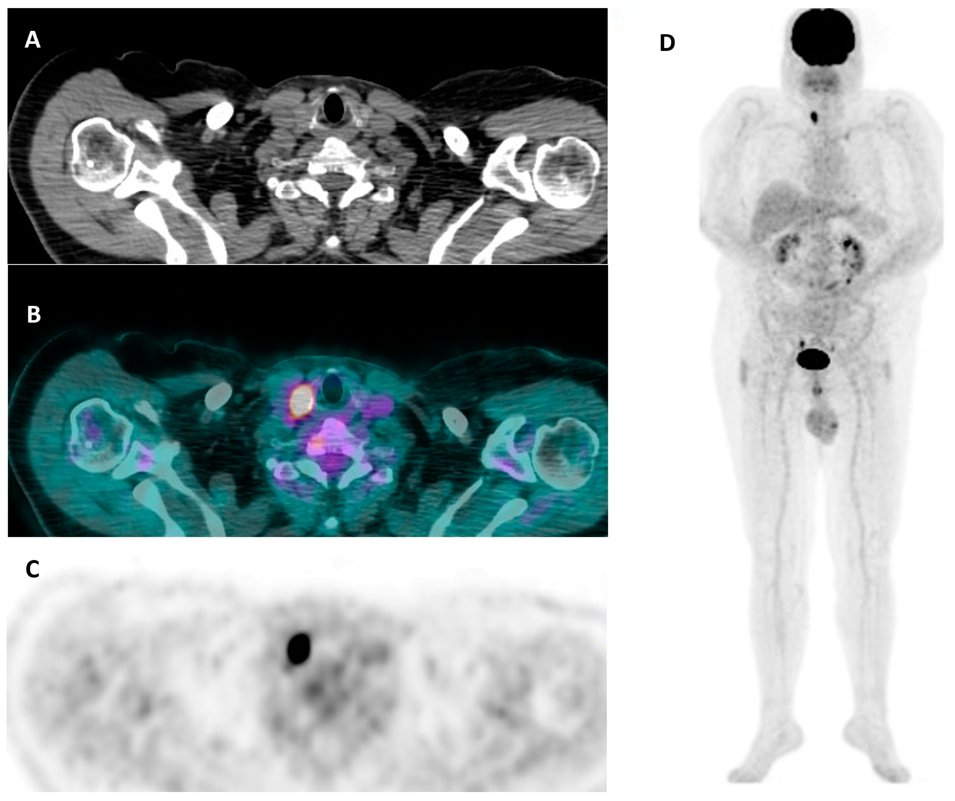 Cancers 16 00311 g006