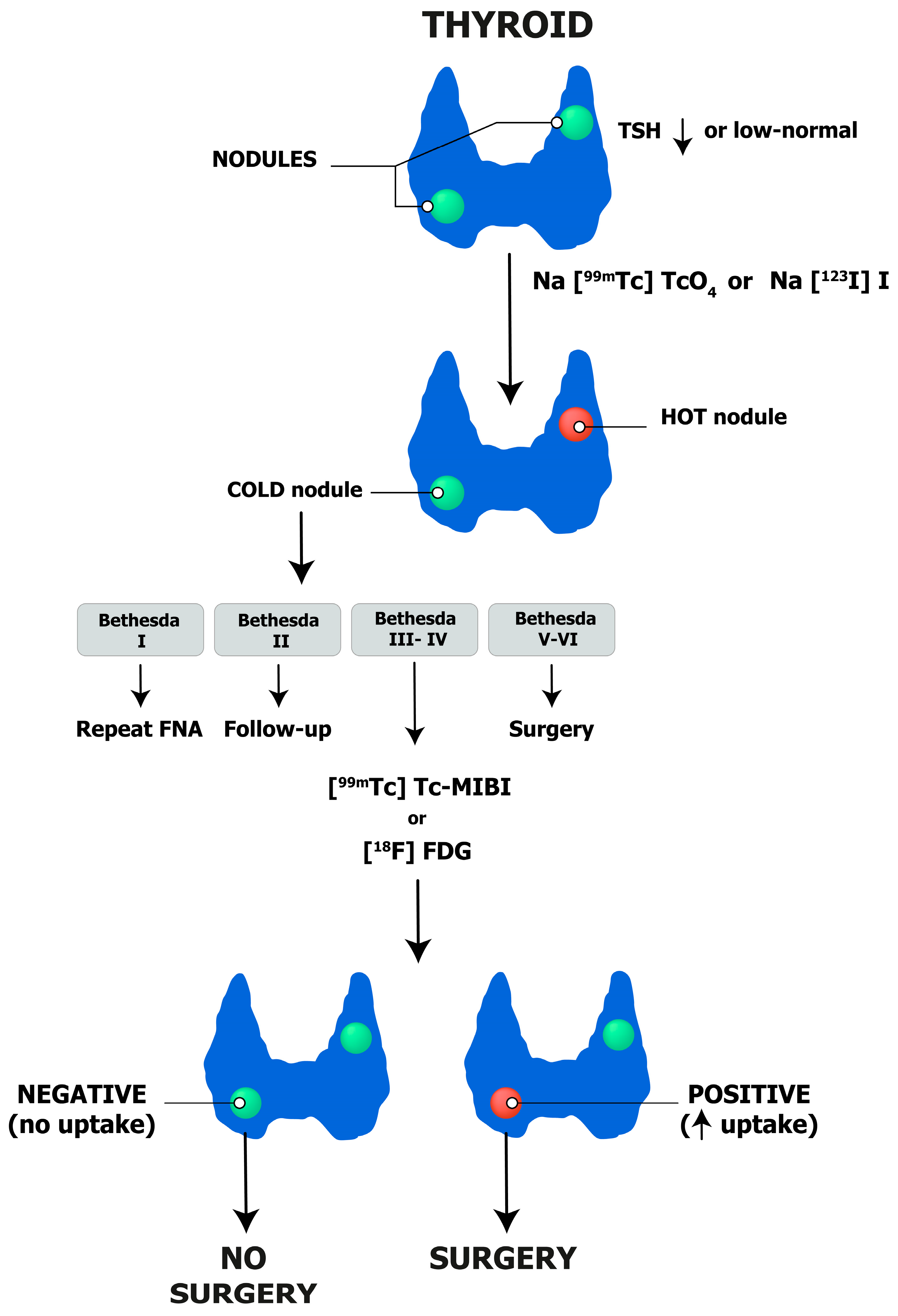 Cancers | Free Full-Text | Integrated Diagnostics of Thyroid Nodules