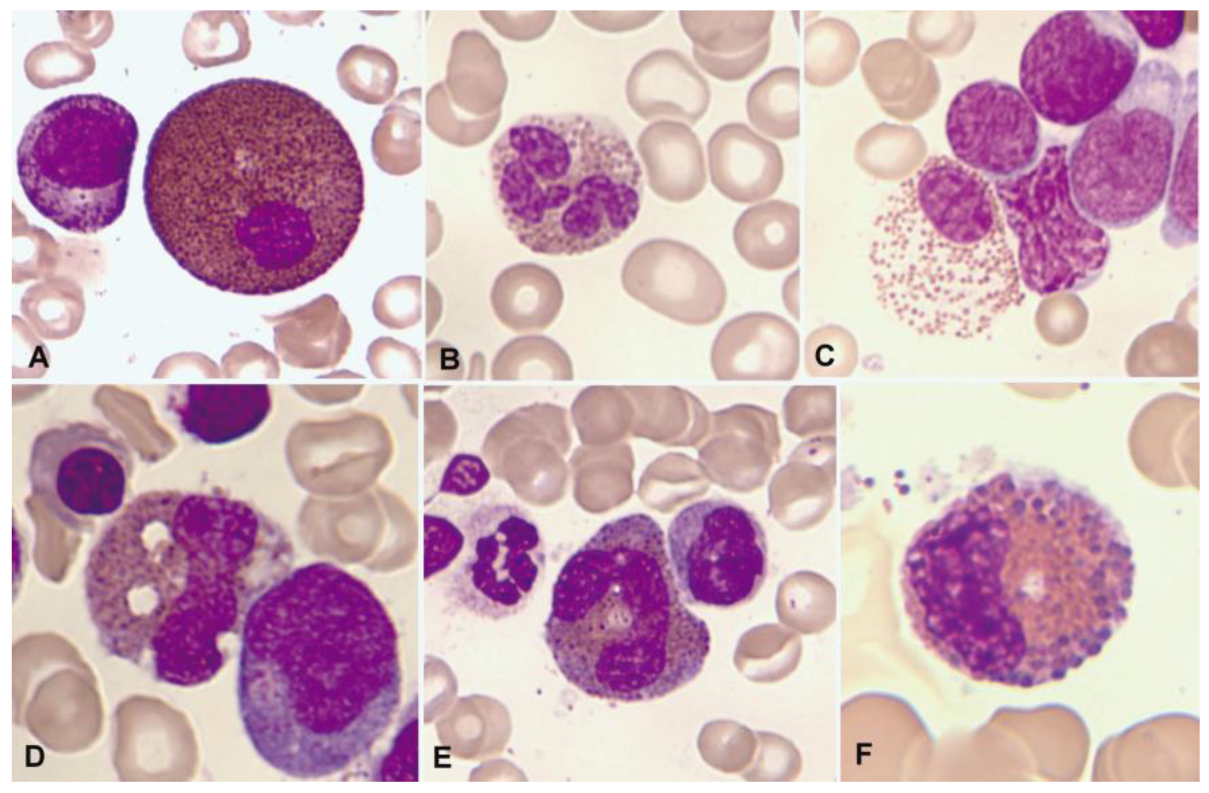 Cancers 16 00337 g002 Cancers 16 00337 g002