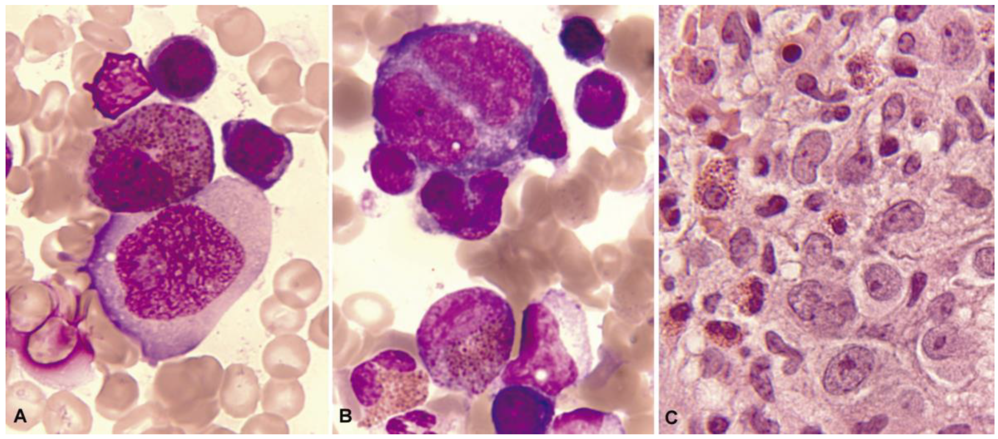 Cancers 16 00337 g005 Cancers 16 00337 g005