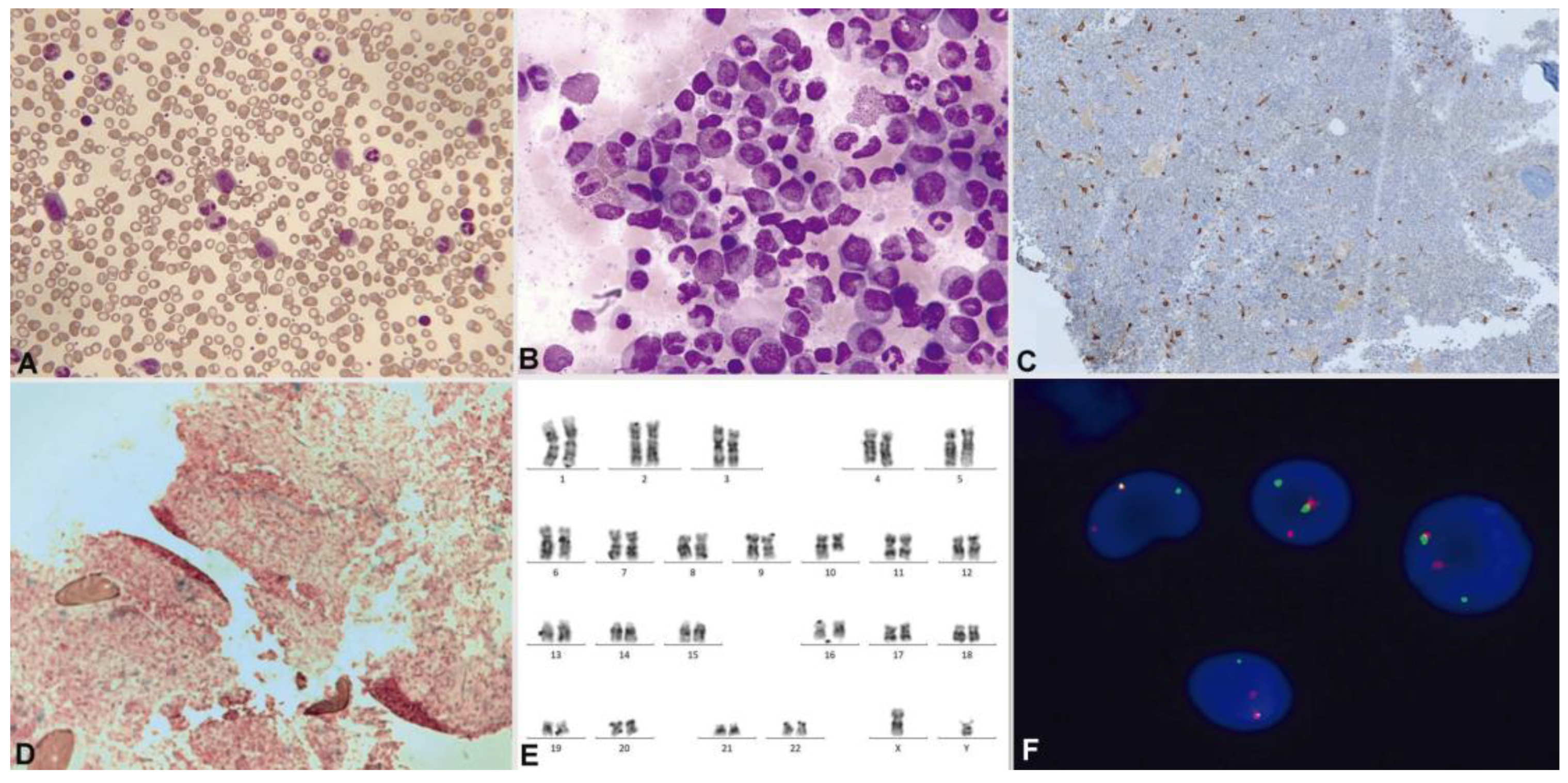 Cancers 16 00337 g009 Cancers 16 00337 g009