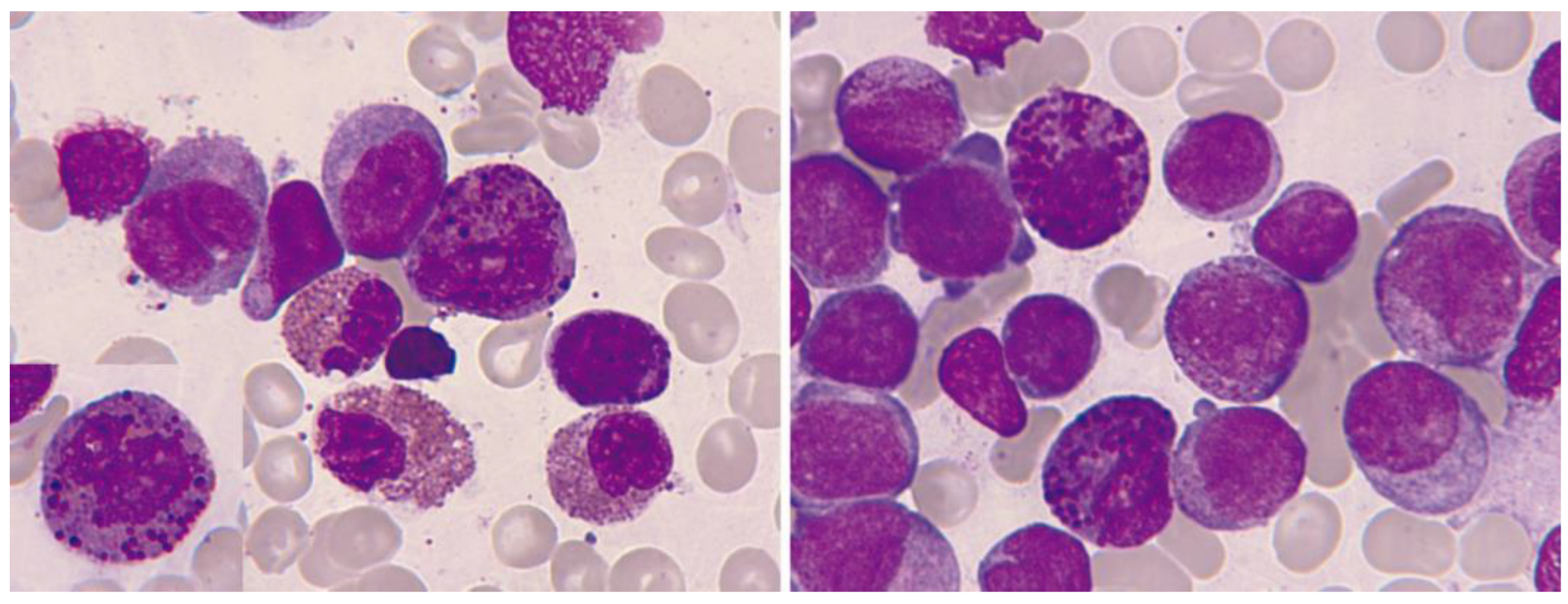 Cancers 16 00337 g010 Cancers 16 00337 g010