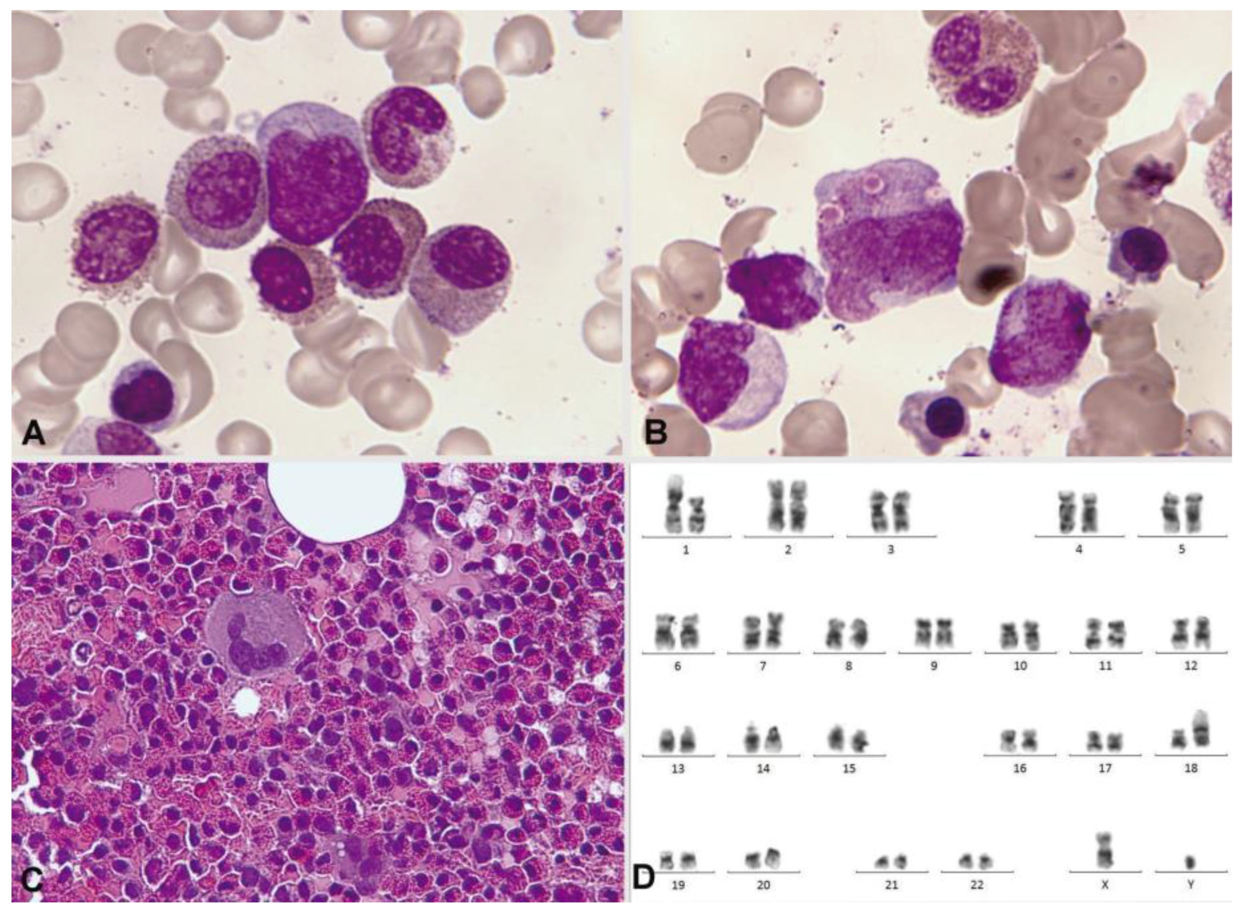 Cancers 16 00337 g011 Cancers 16 00337 g011