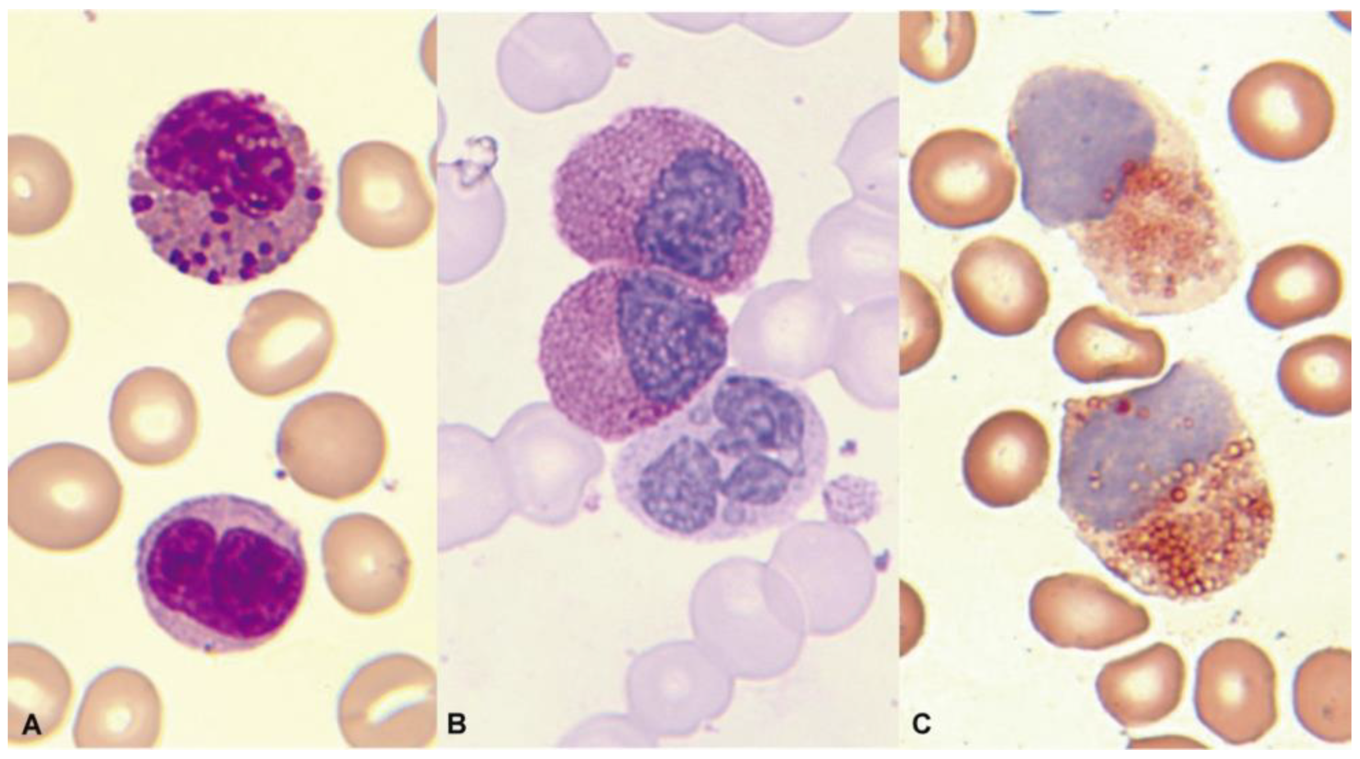 Cancers 16 00337 g012 Cancers 16 00337 g012