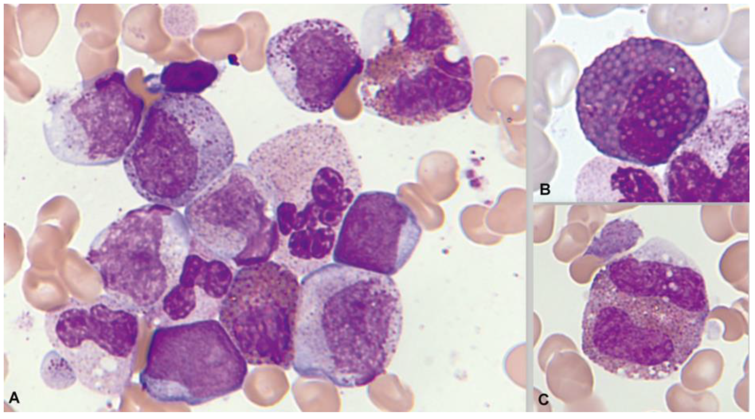 Cancers 16 00337 g013 Cancers 16 00337 g013