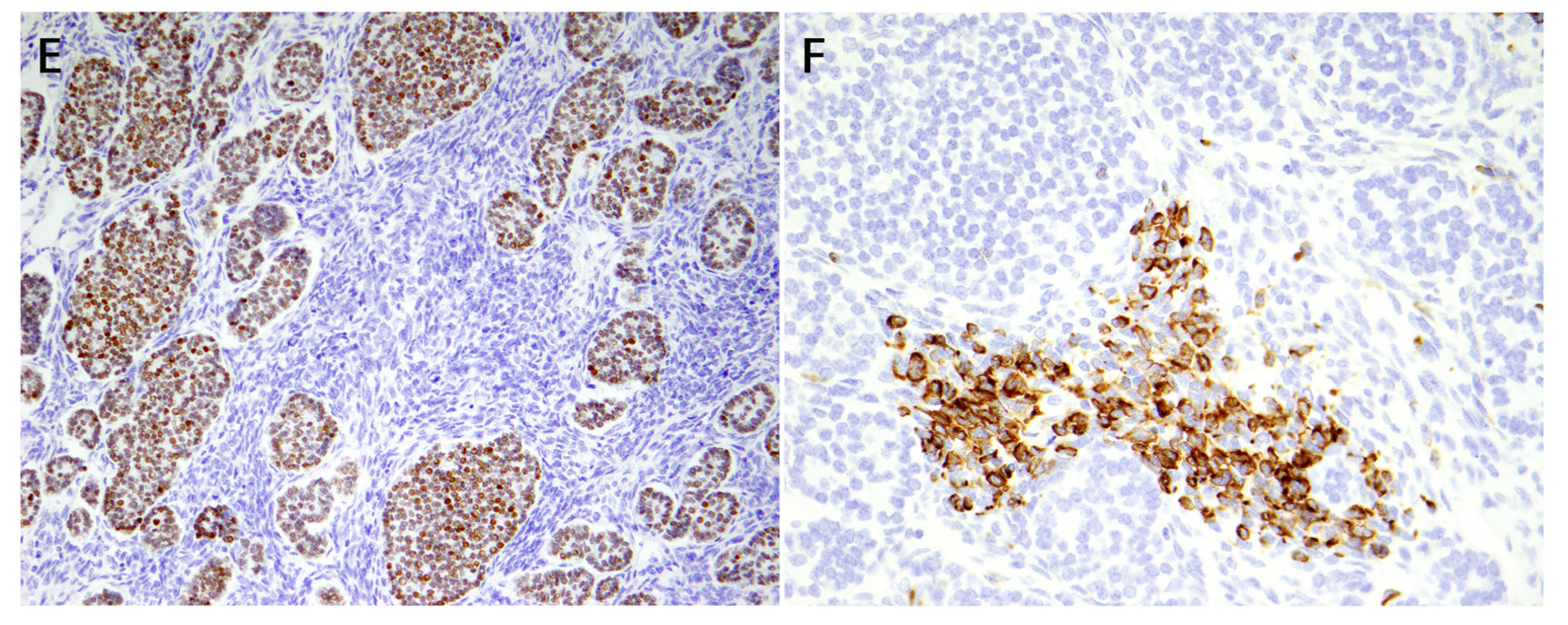 Cancers 16 00347 g011b