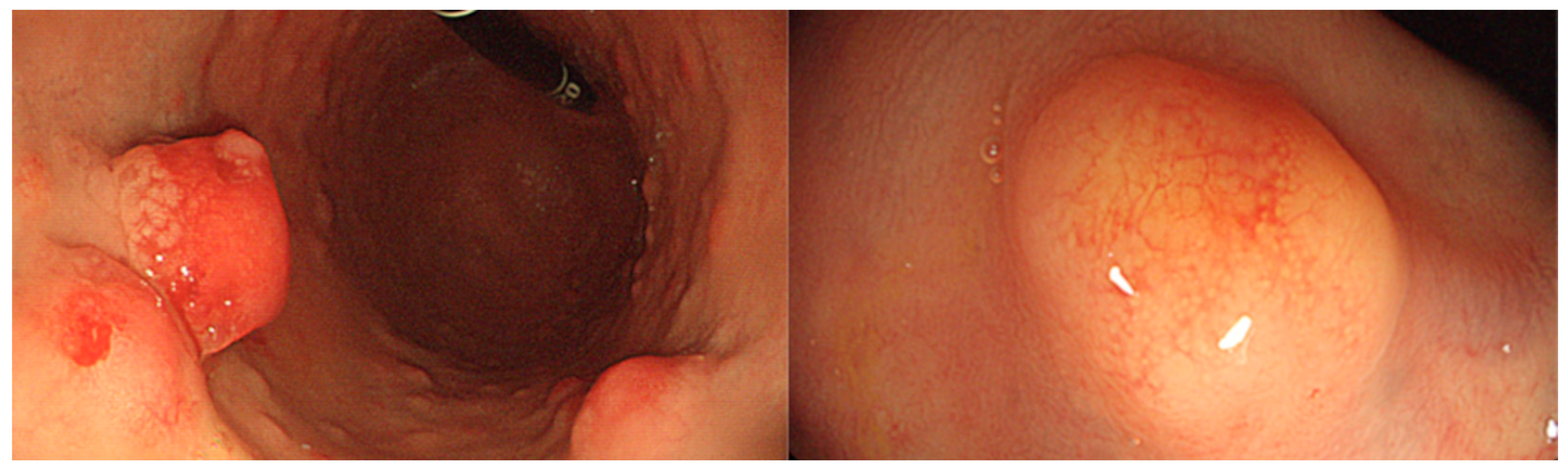 Cancers 16 00352 g001 Cancers 16 00352 g001