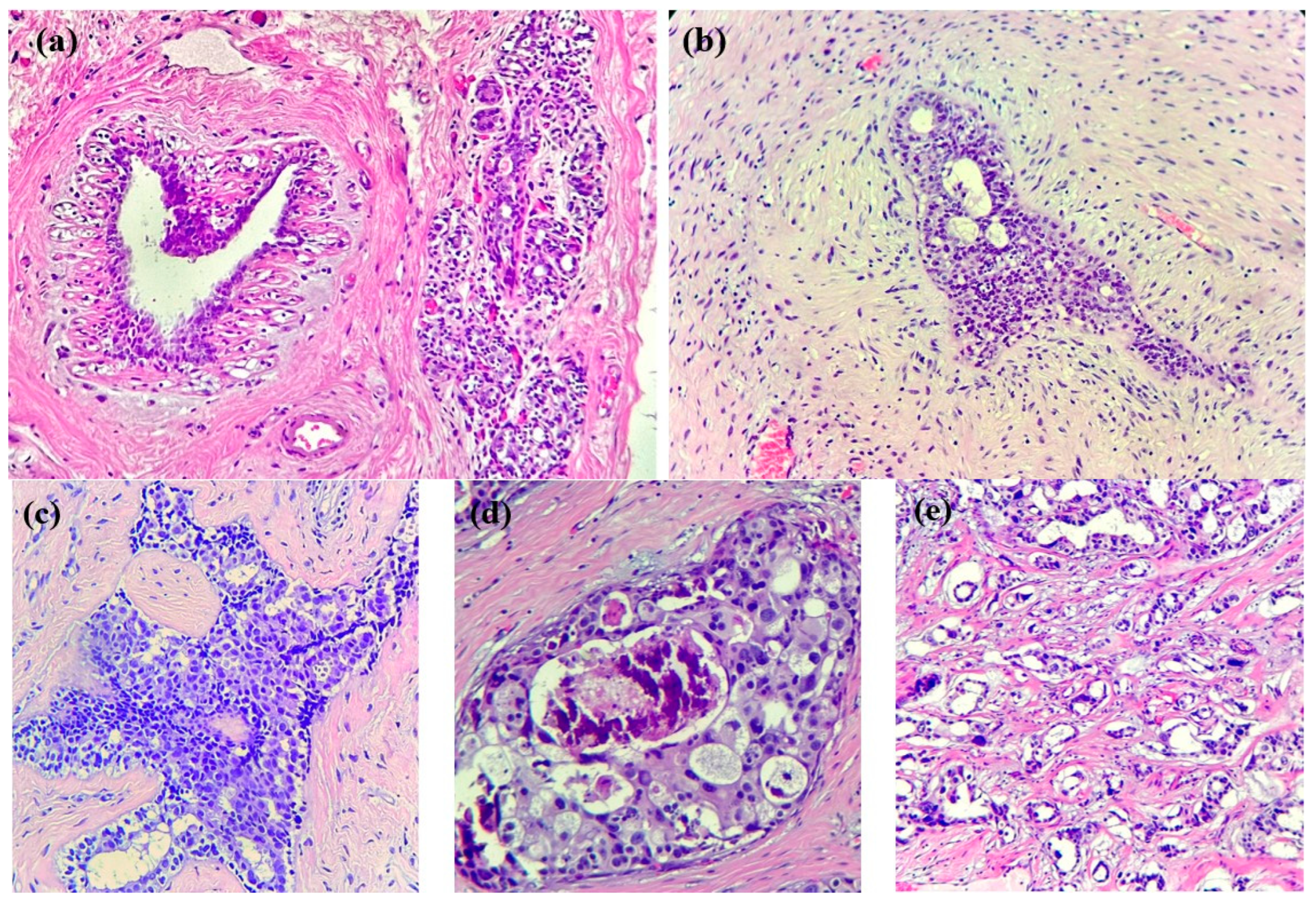 Cancers 16 00381 g001 Cancers 16 00381 g001