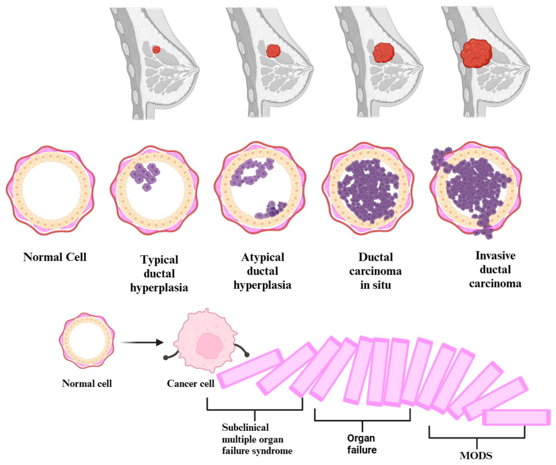 Cancers 16 00381 g002 Cancers 16 00381 g002