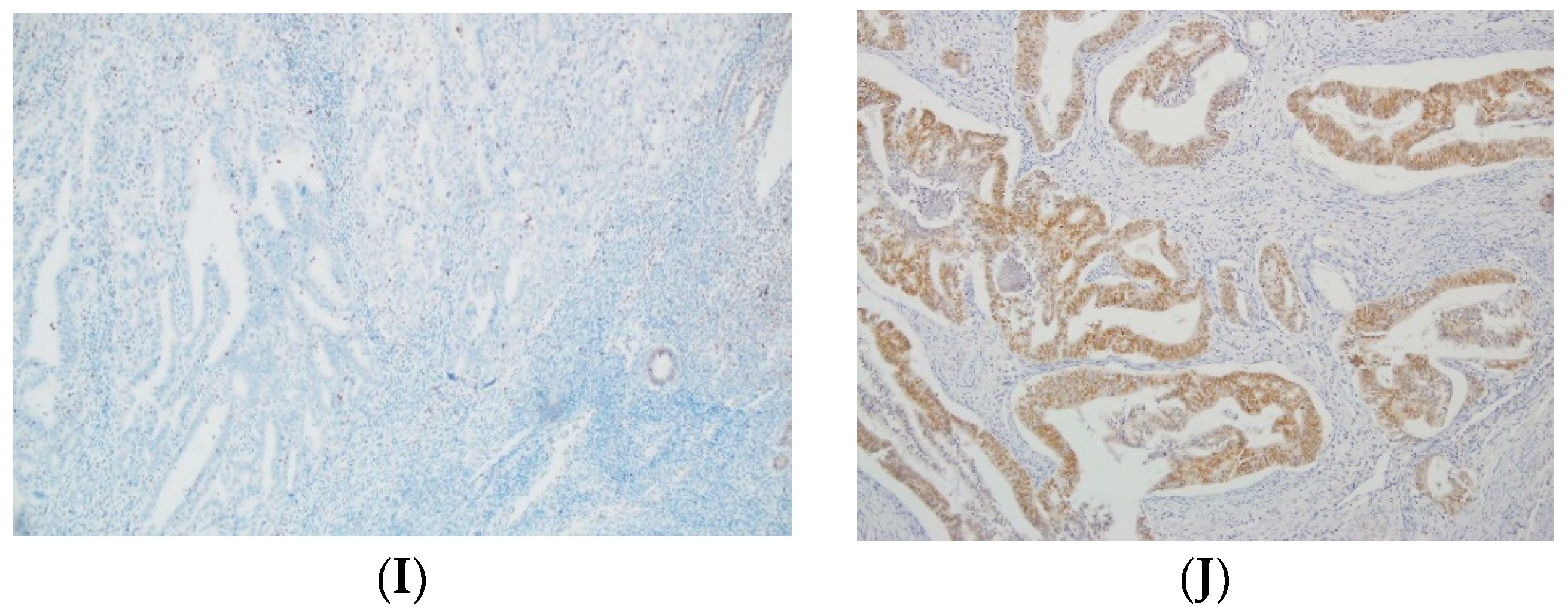 Cancers 16 00390 g001b