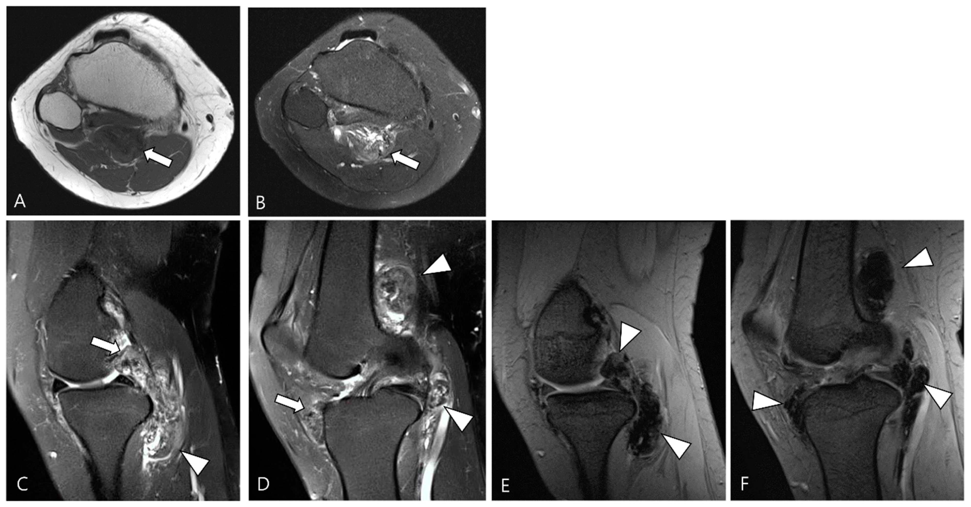 Cancers 16 00402 g001 Cancers 16 00402 g001