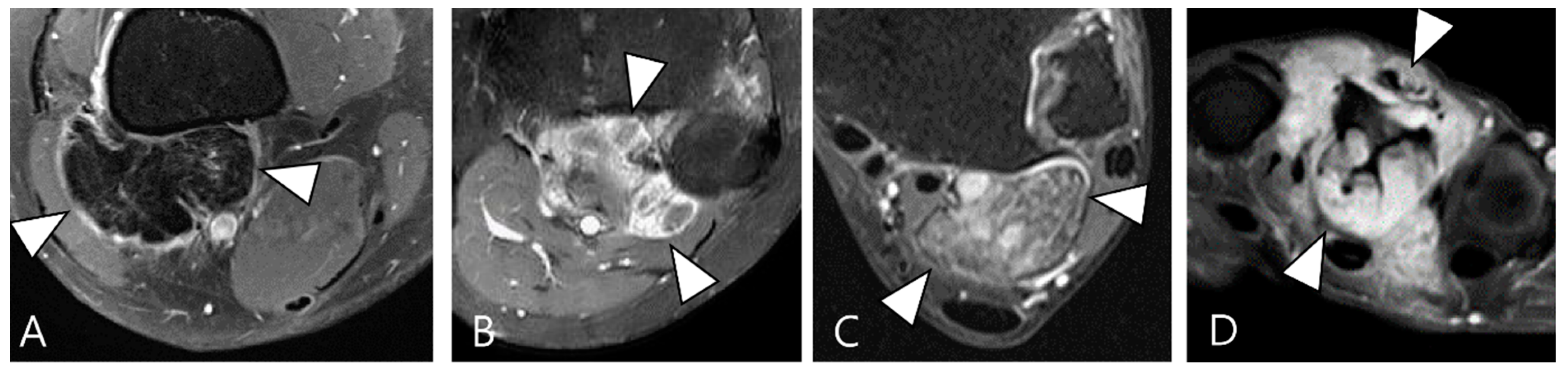 Cancers 16 00402 g002 Cancers 16 00402 g002