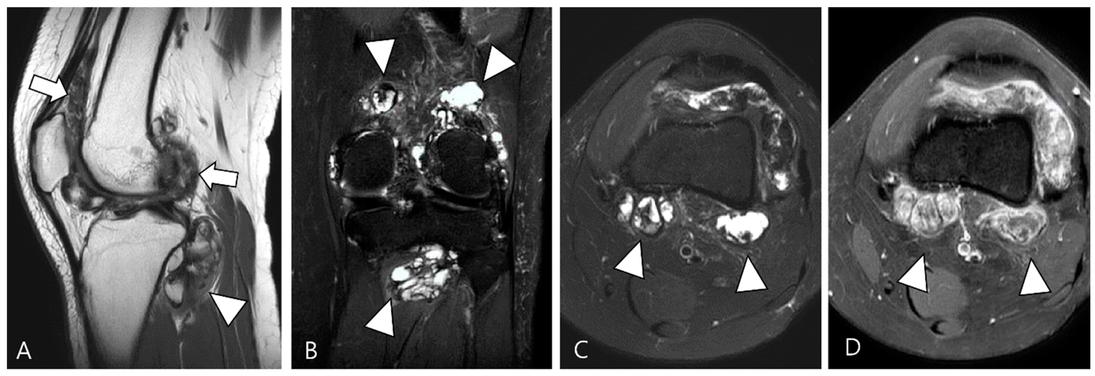 Cancers 16 00402 g003 Cancers 16 00402 g003