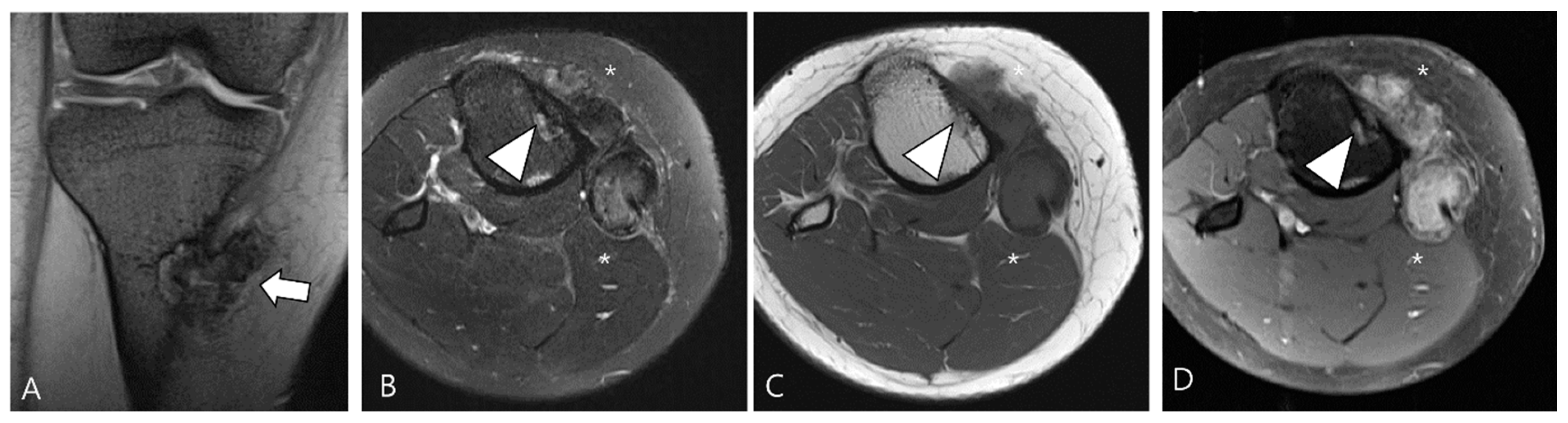 Cancers 16 00402 g004 Cancers 16 00402 g004
