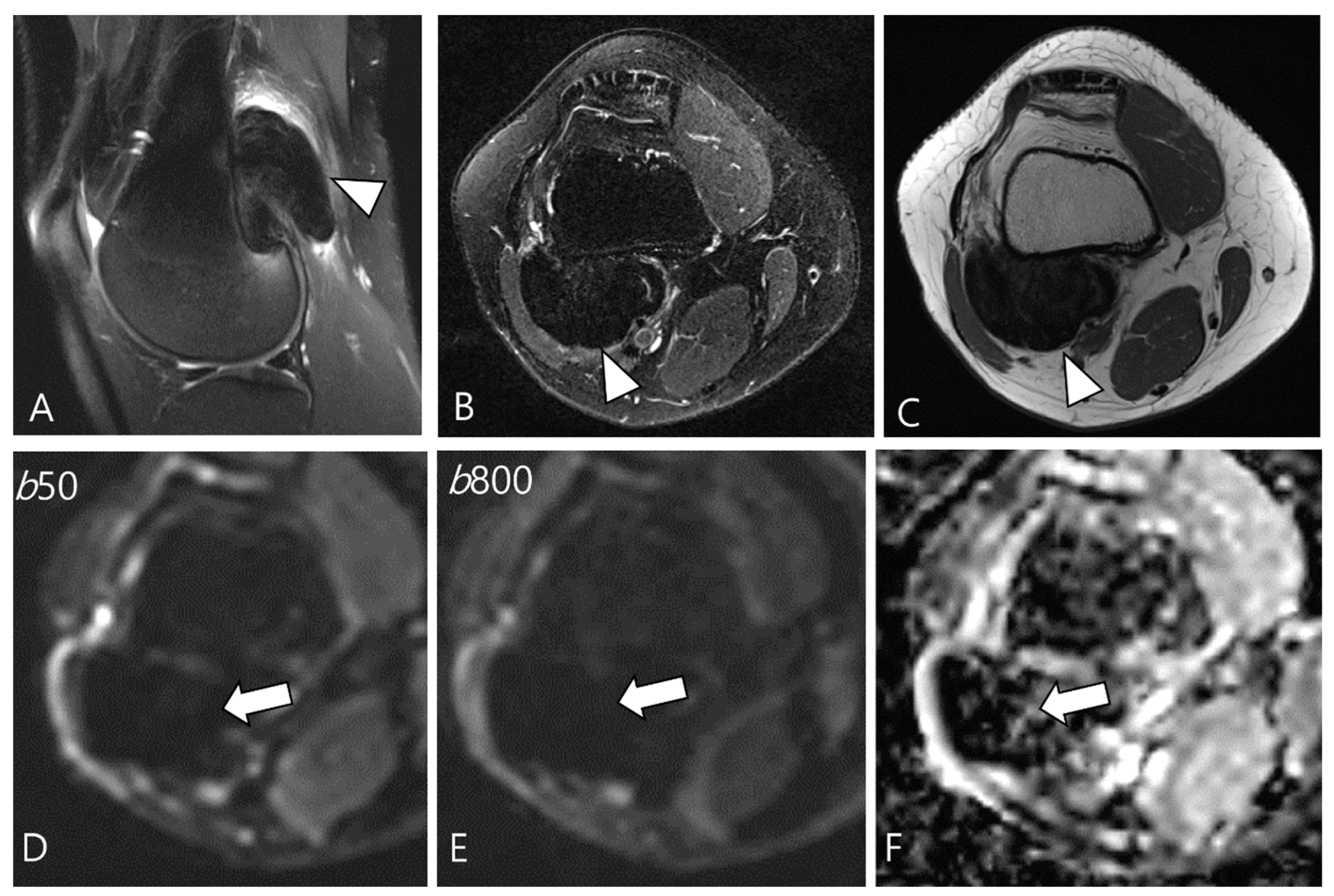 Cancers 16 00402 g007 Cancers 16 00402 g007