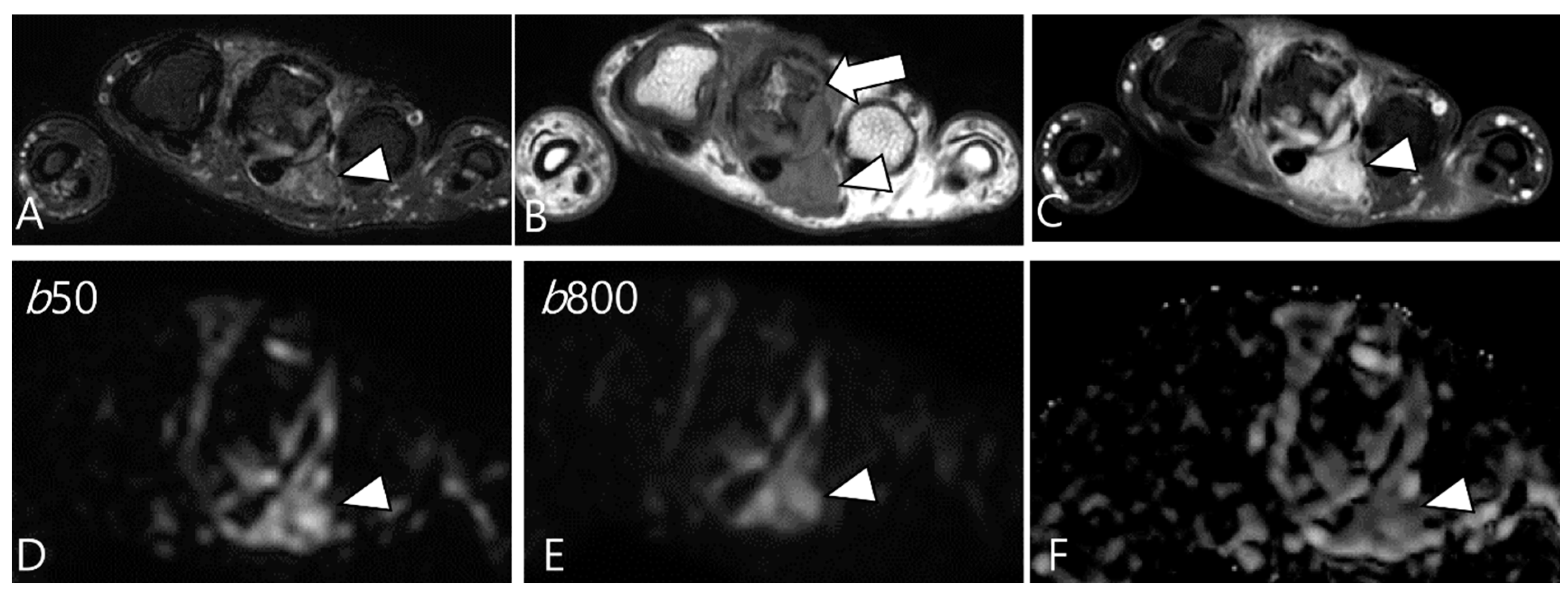 Cancers 16 00402 g009 Cancers 16 00402 g009