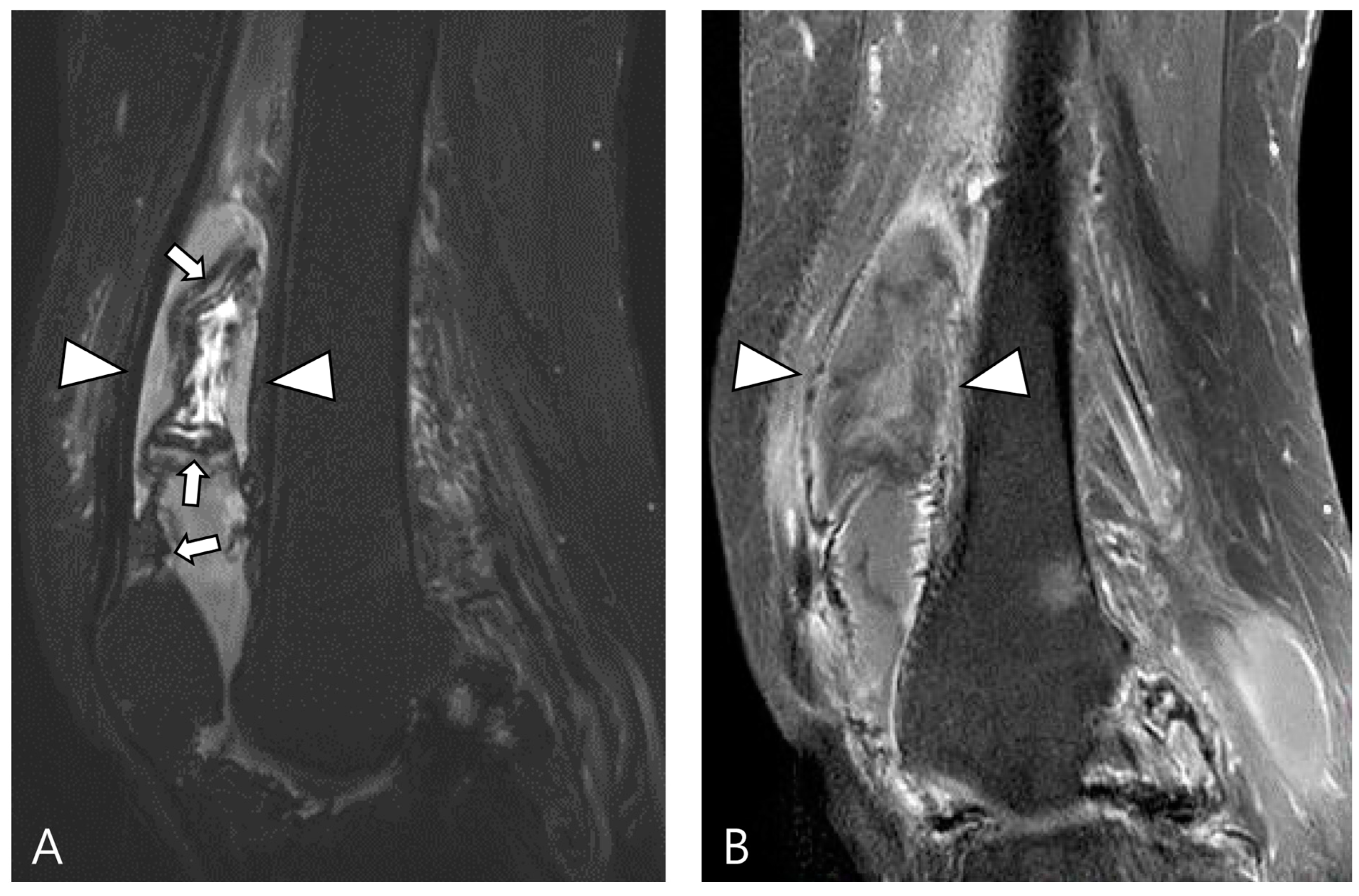 Cancers 16 00402 g010 Cancers 16 00402 g010