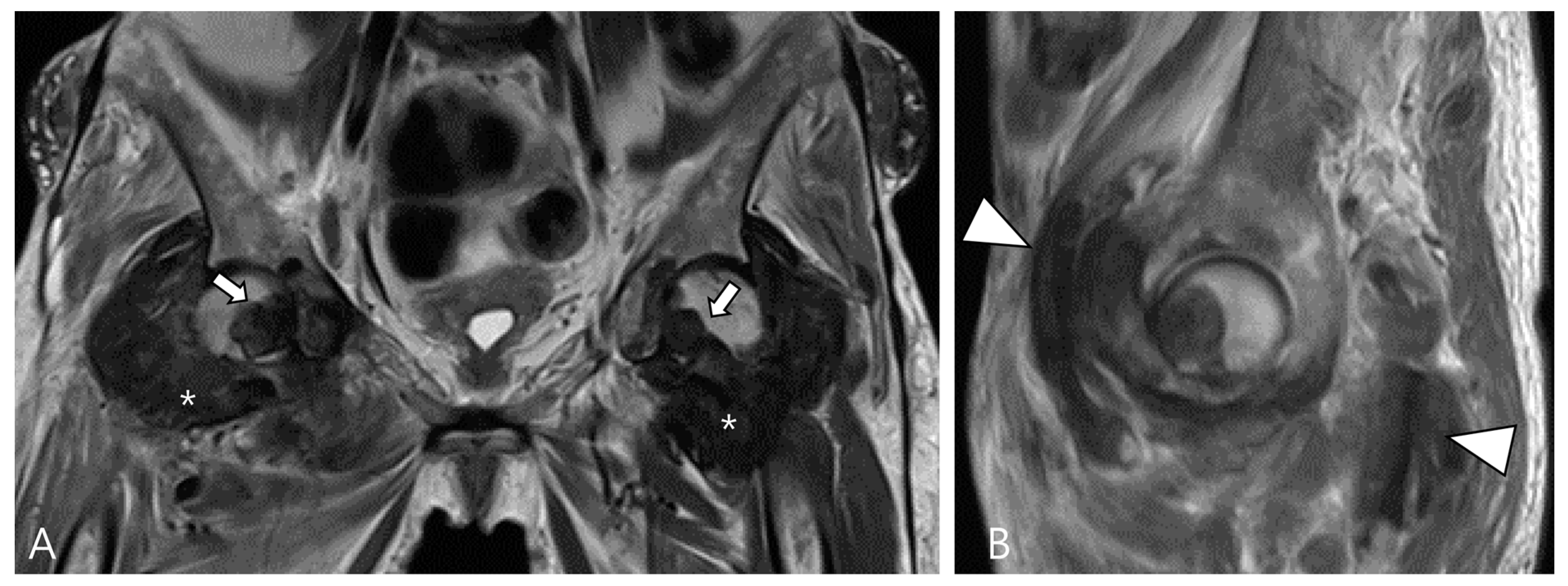 Cancers 16 00402 g012 Cancers 16 00402 g012