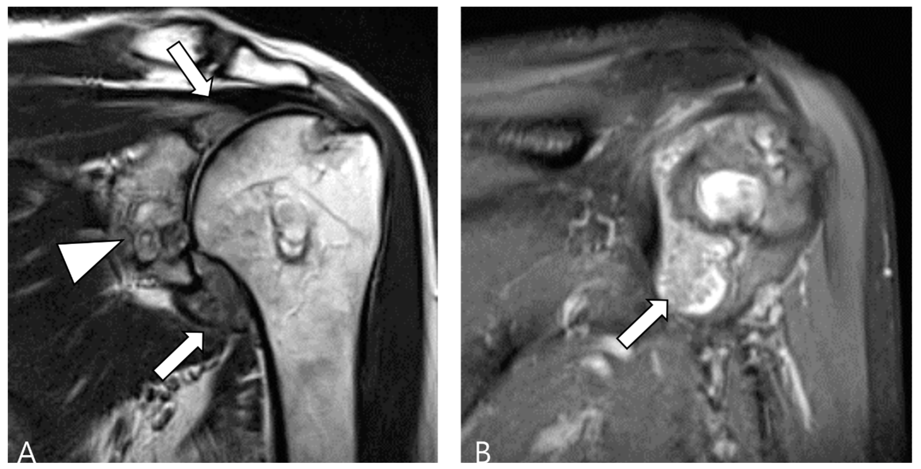 Cancers 16 00402 g013 Cancers 16 00402 g013