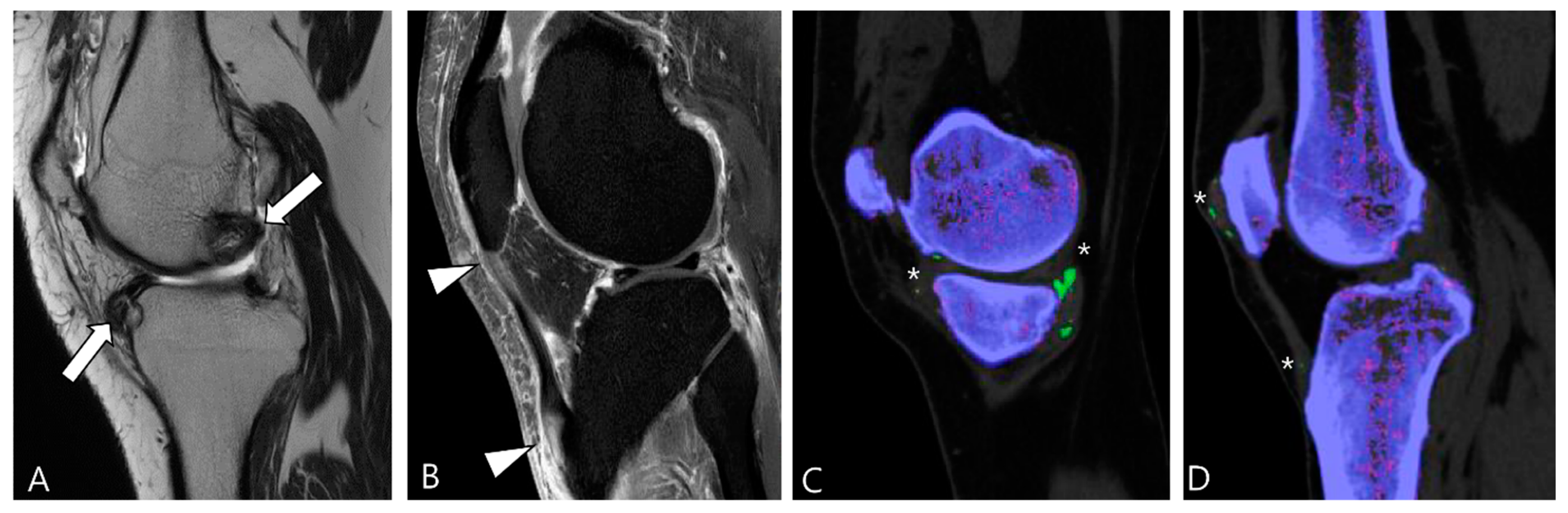 Cancers 16 00402 g014 Cancers 16 00402 g014