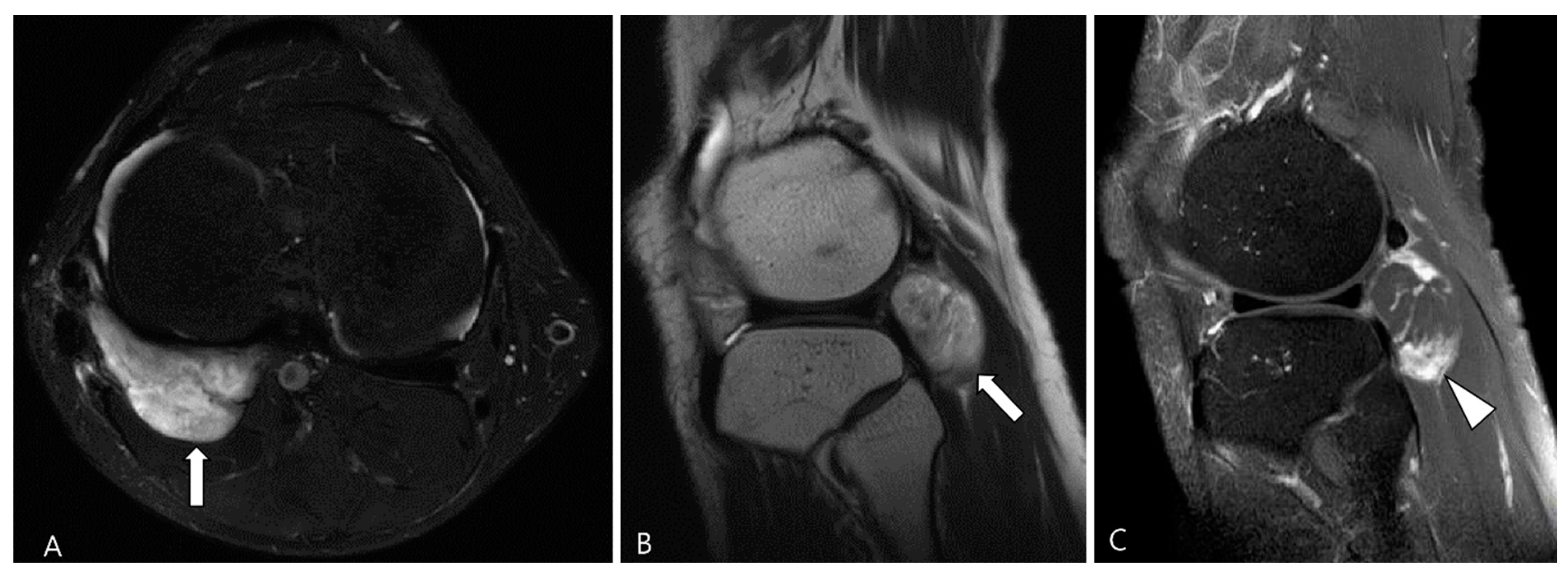Cancers 16 00402 g015 Cancers 16 00402 g015