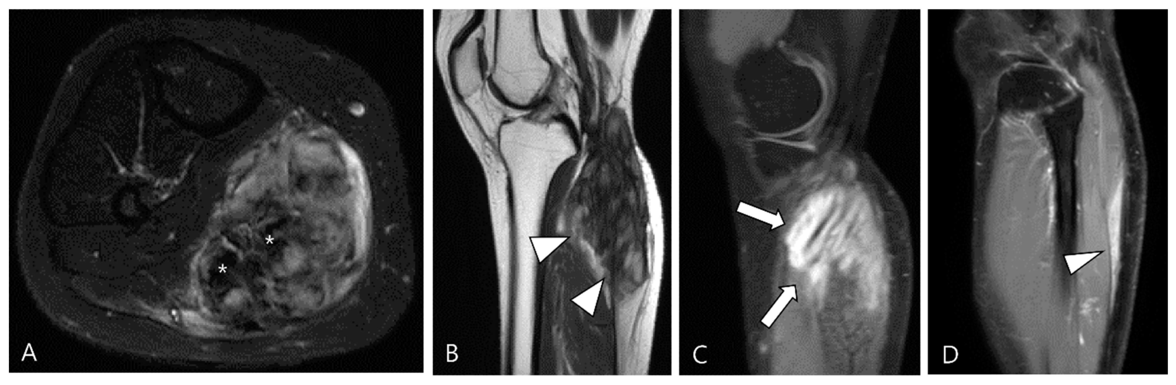 Cancers 16 00402 g016 Cancers 16 00402 g016