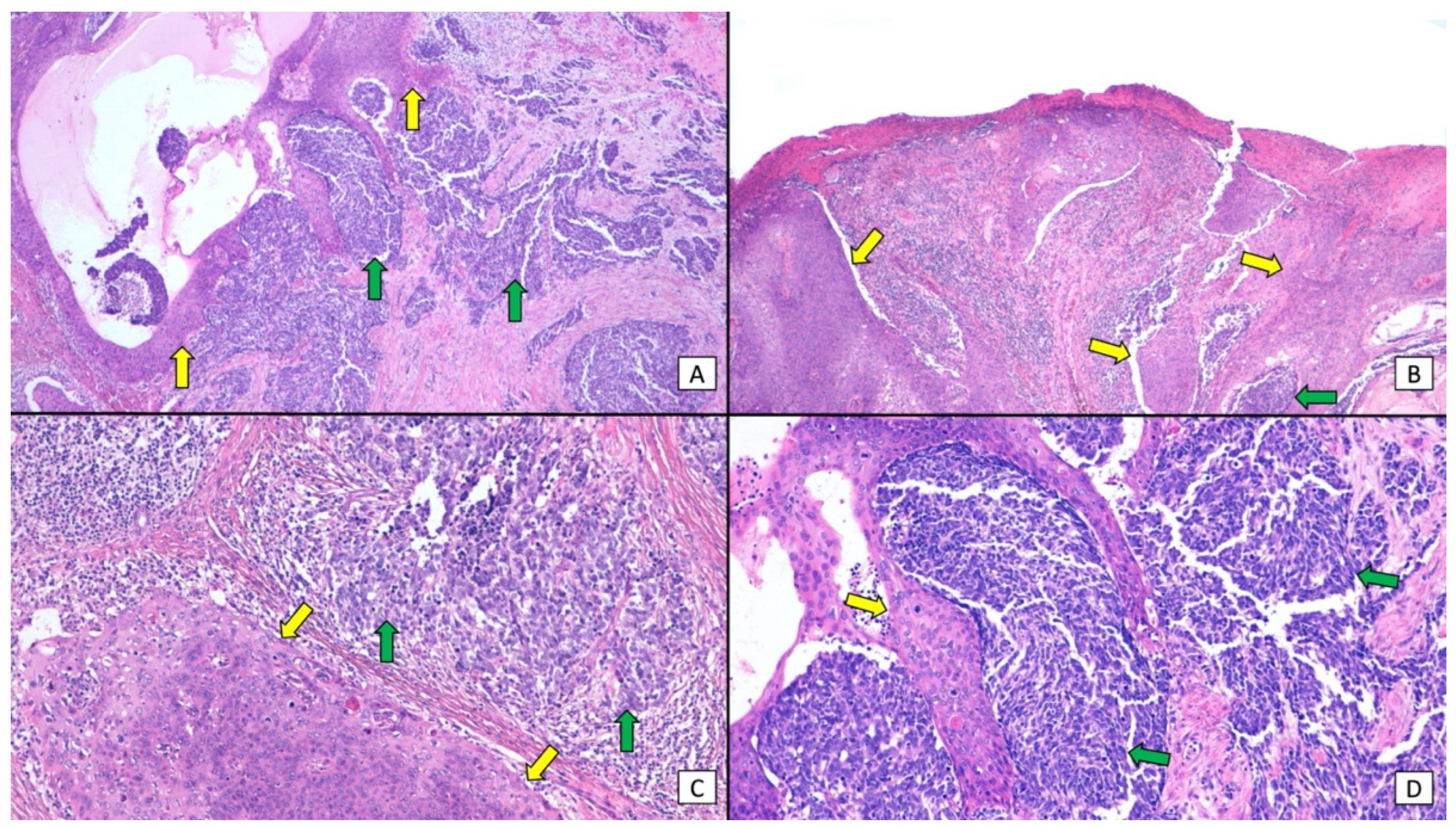 Cancers 16 00411 g002
