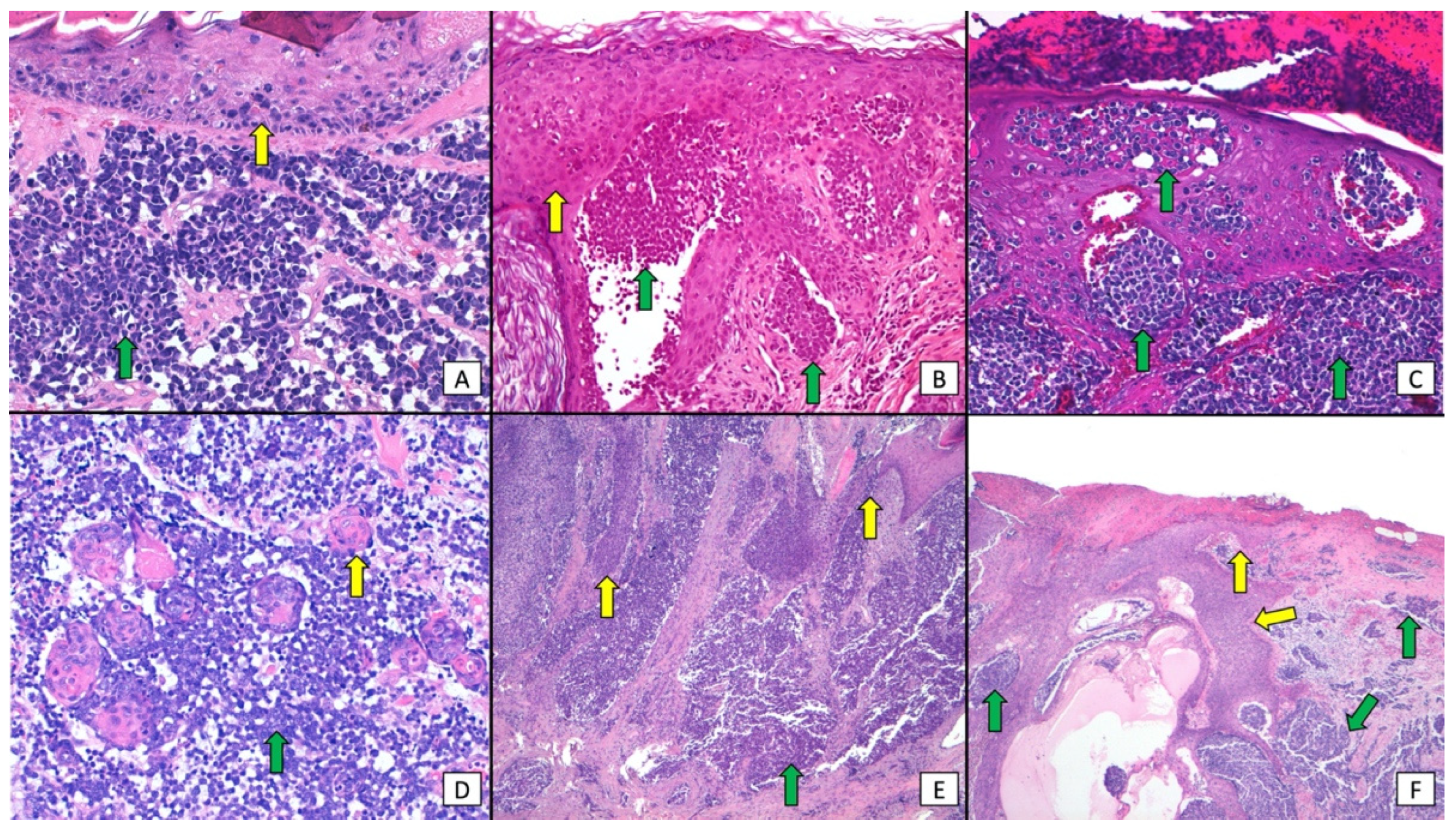 Cancers 16 00411 g005