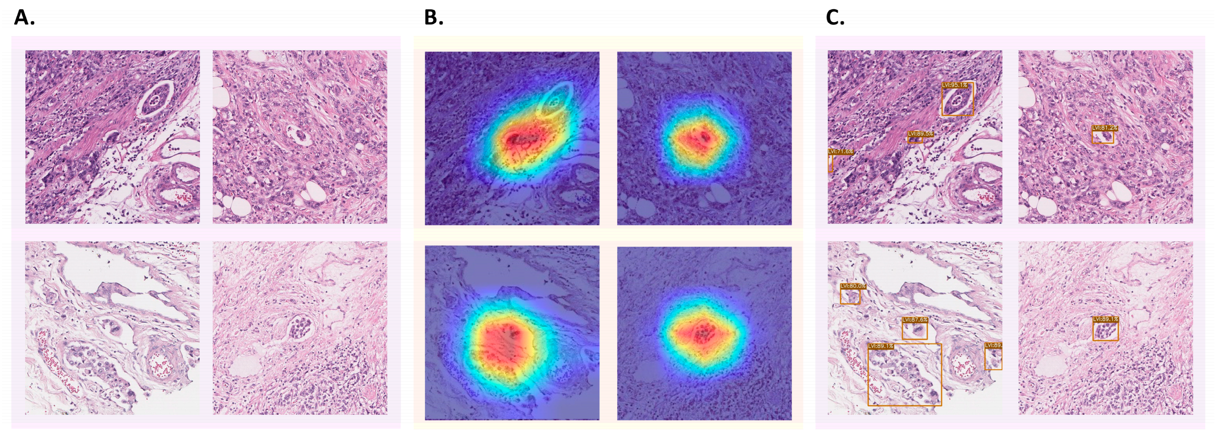 Cancers 16 00430 g003
