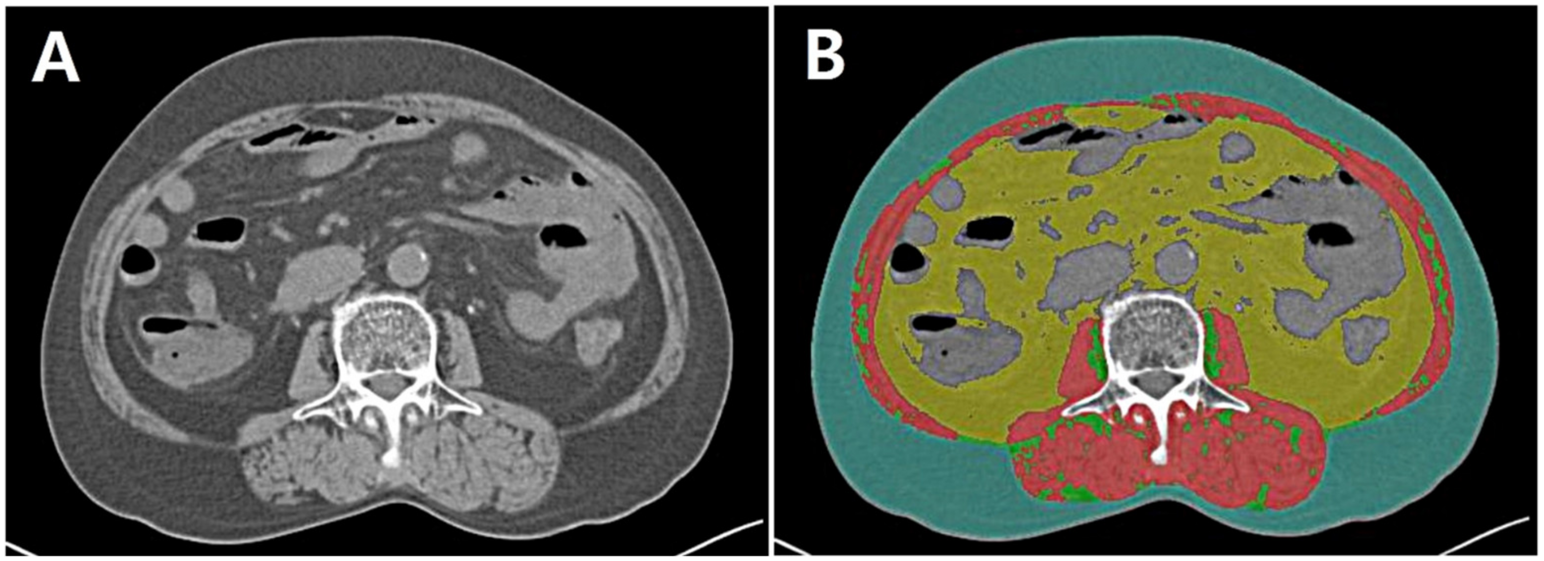 Cancers 16 00454 g002