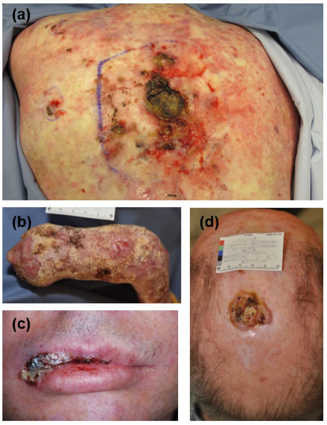 Cancers 16 00471 g001