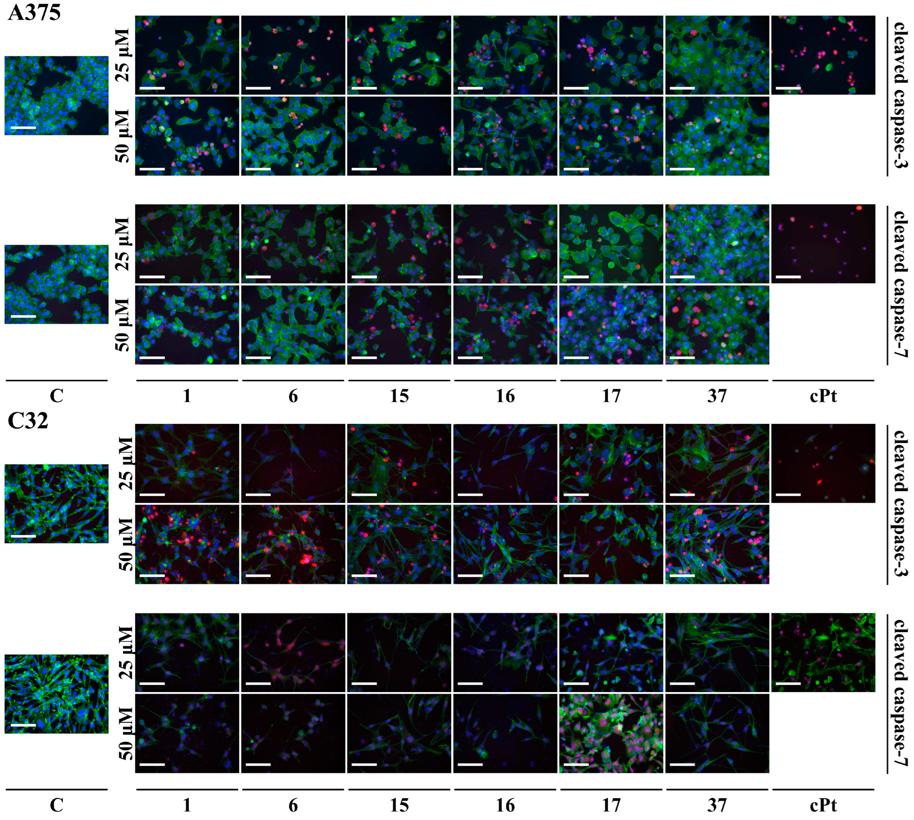Cancers 16 00487 g004