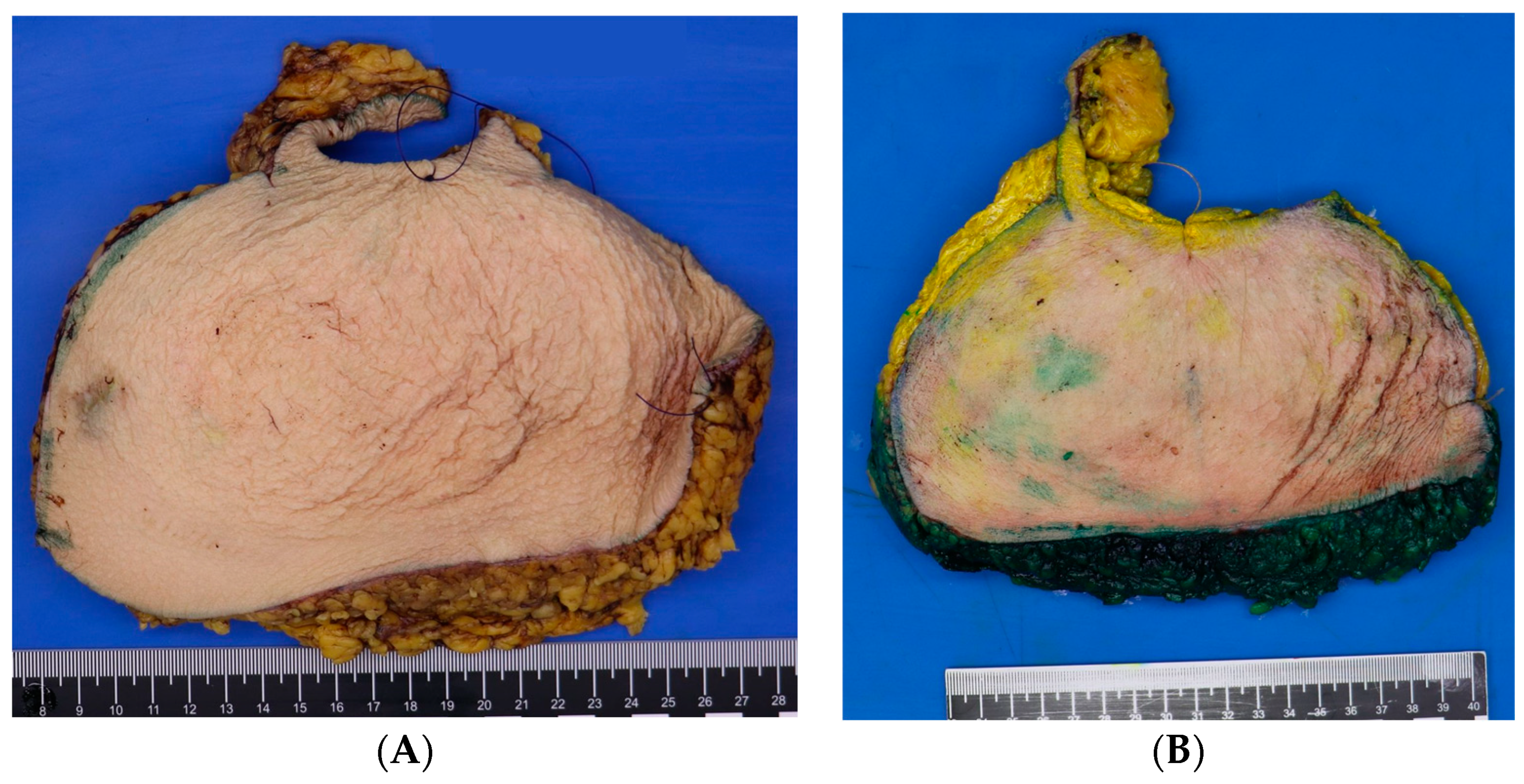 Cancers 16 00497 g002