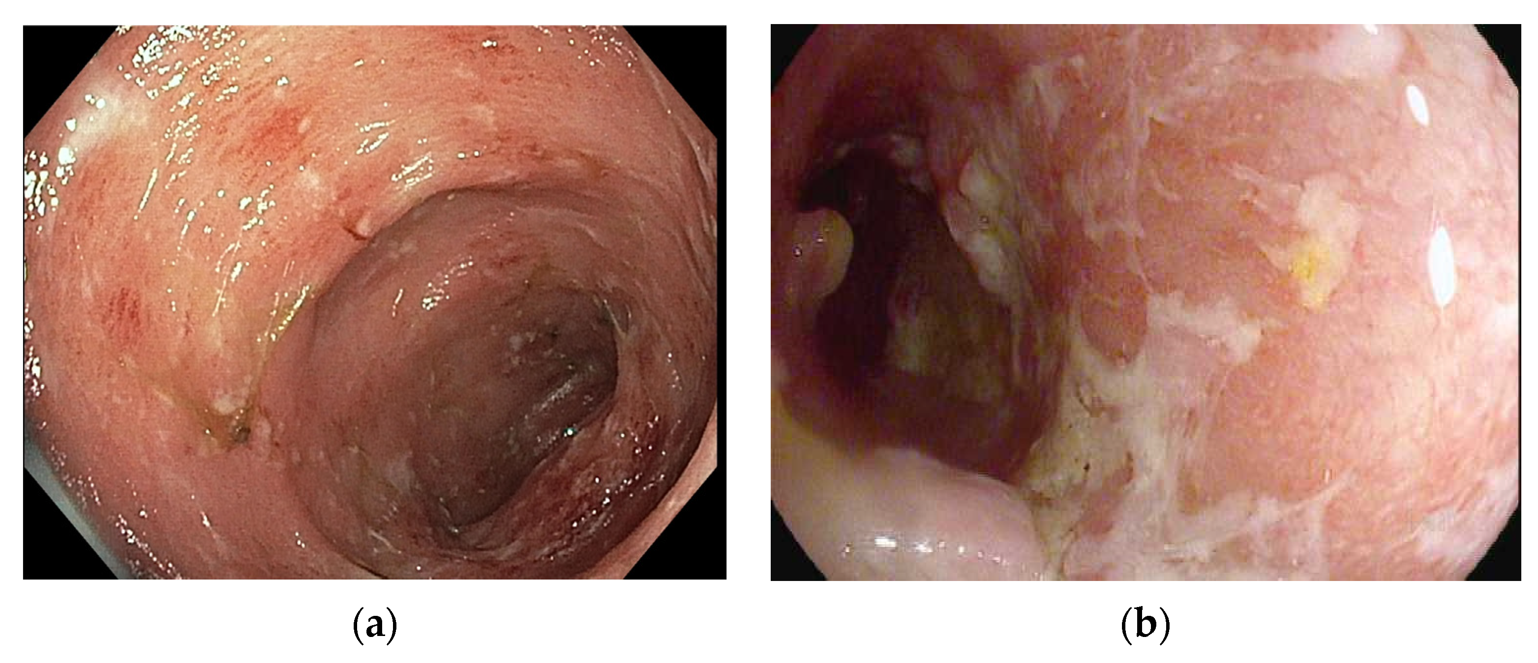 Cancers 16 00501 g002