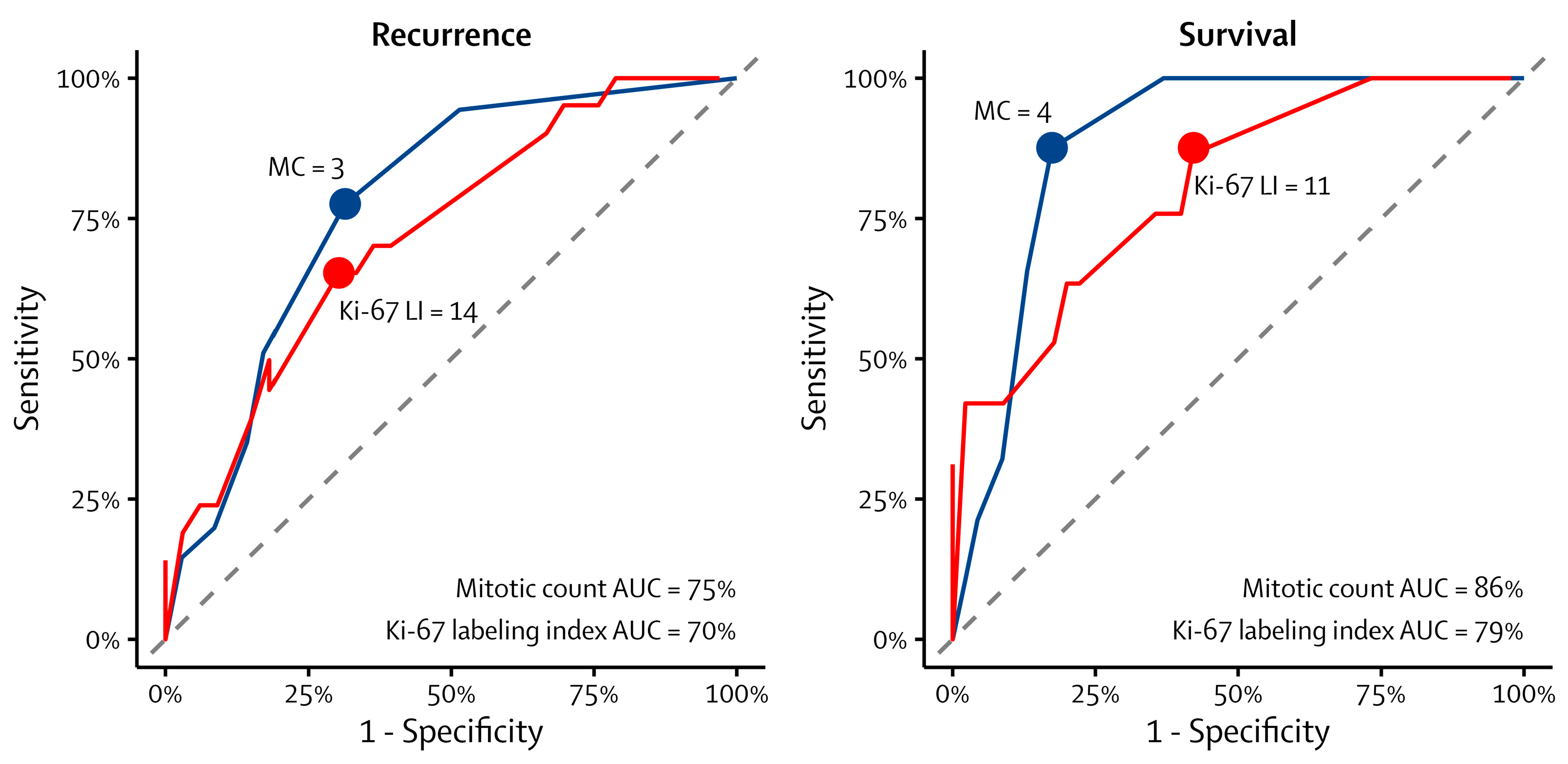Cancers Free FullText Prognostic Thresholds of Mitotic Count and Ki67 Labeling Index for