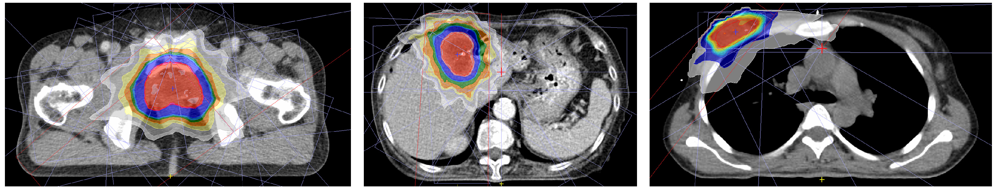 Cancers 16 00526 g003