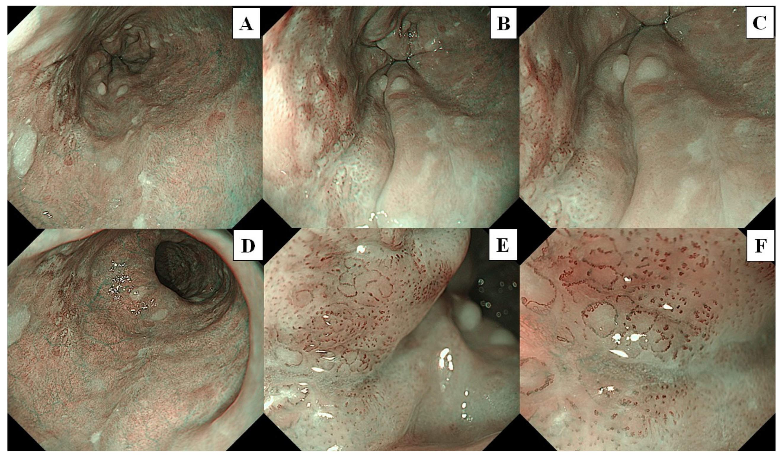 Cancers 16 00529 g004