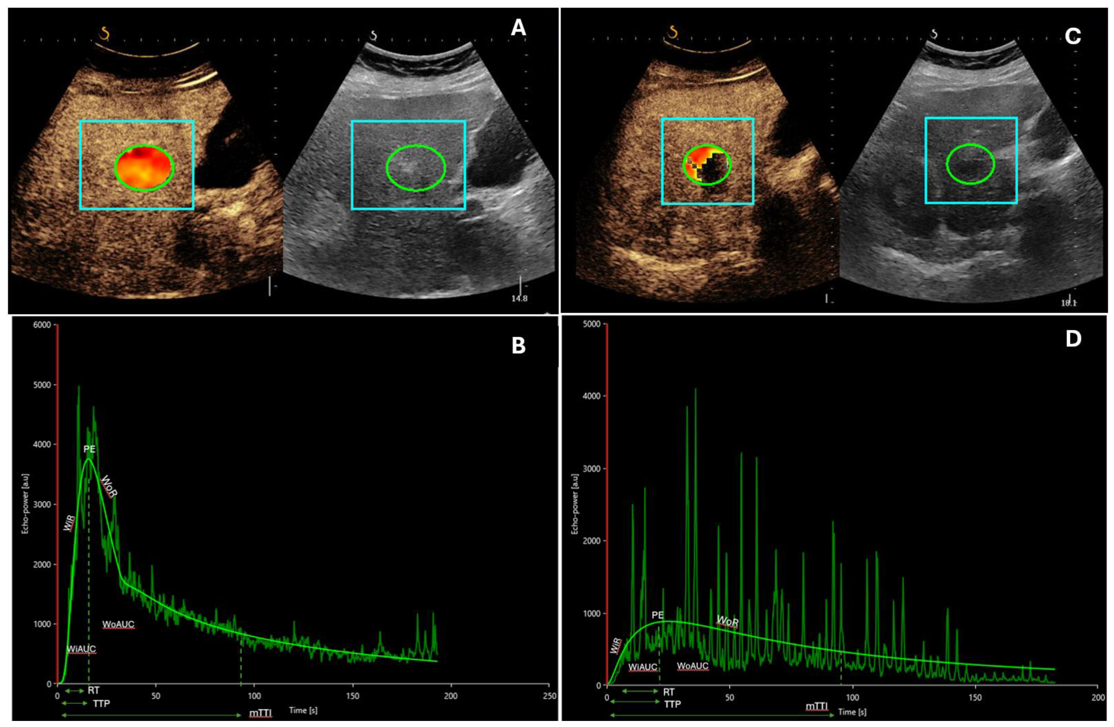 Cancers 16 00551 g001 Cancers 16 00551 g001