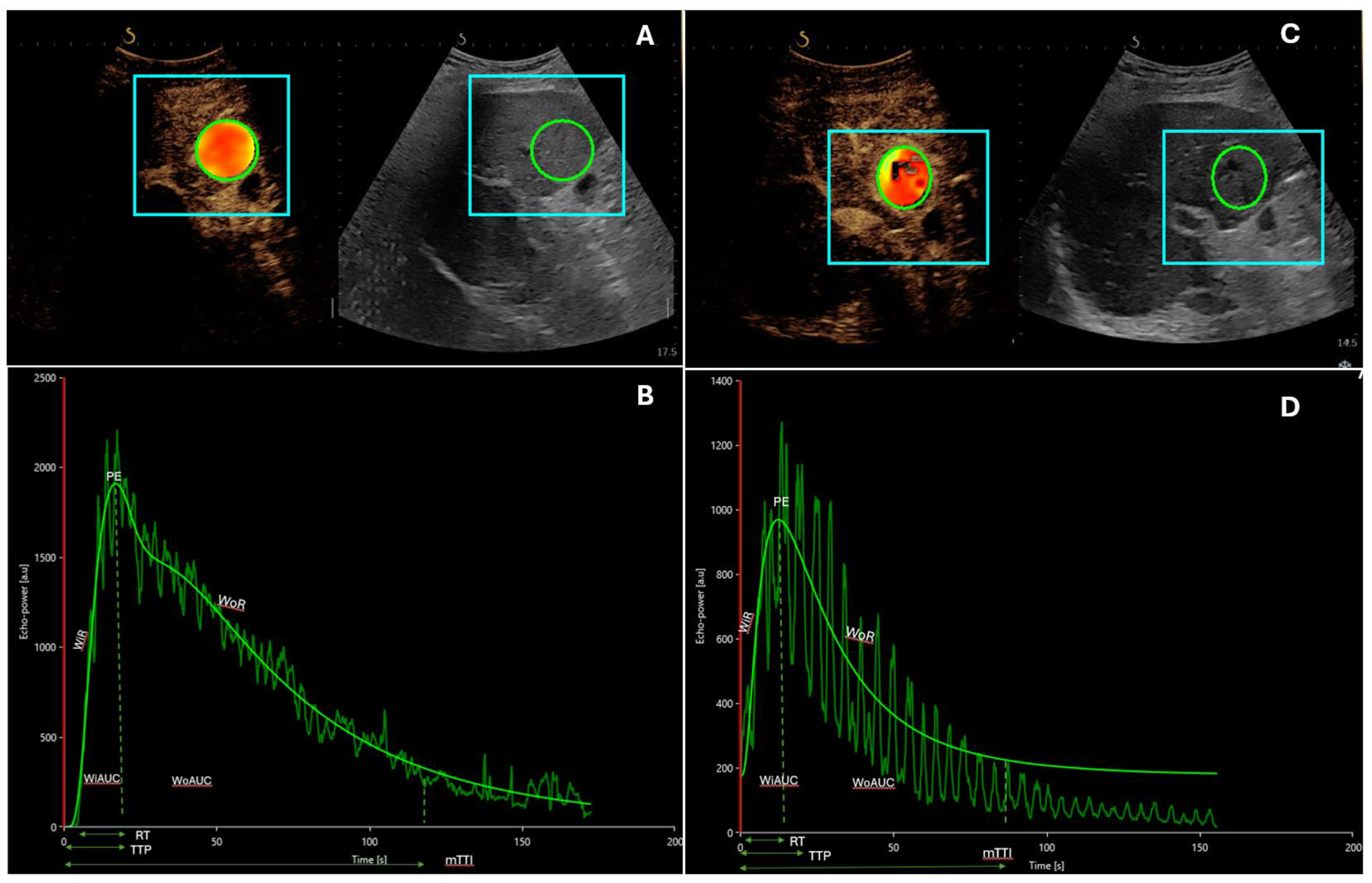 Cancers 16 00551 g002 Cancers 16 00551 g002