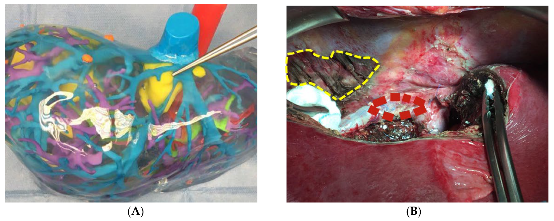 Cancers 16 00571 g001 Cancers 16 00571 g001