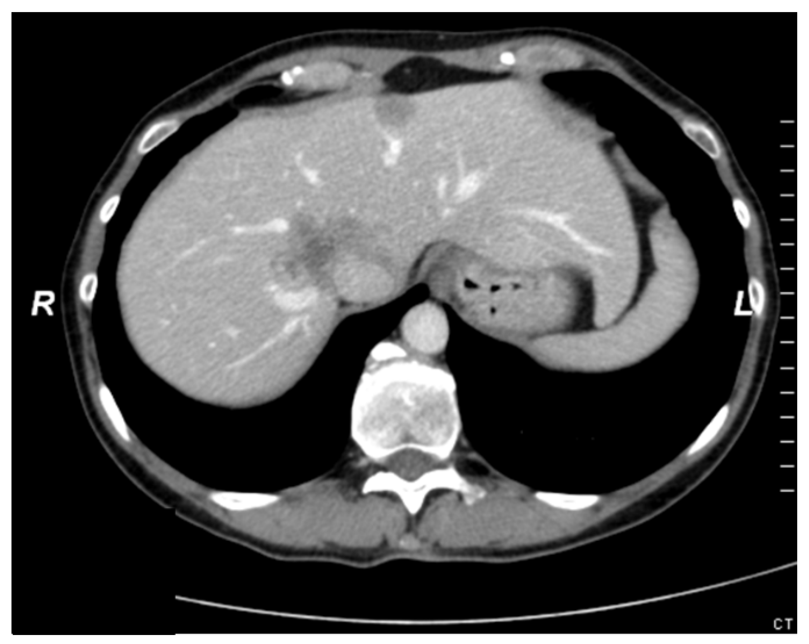 Cancers 16 00571 g003 Cancers 16 00571 g003