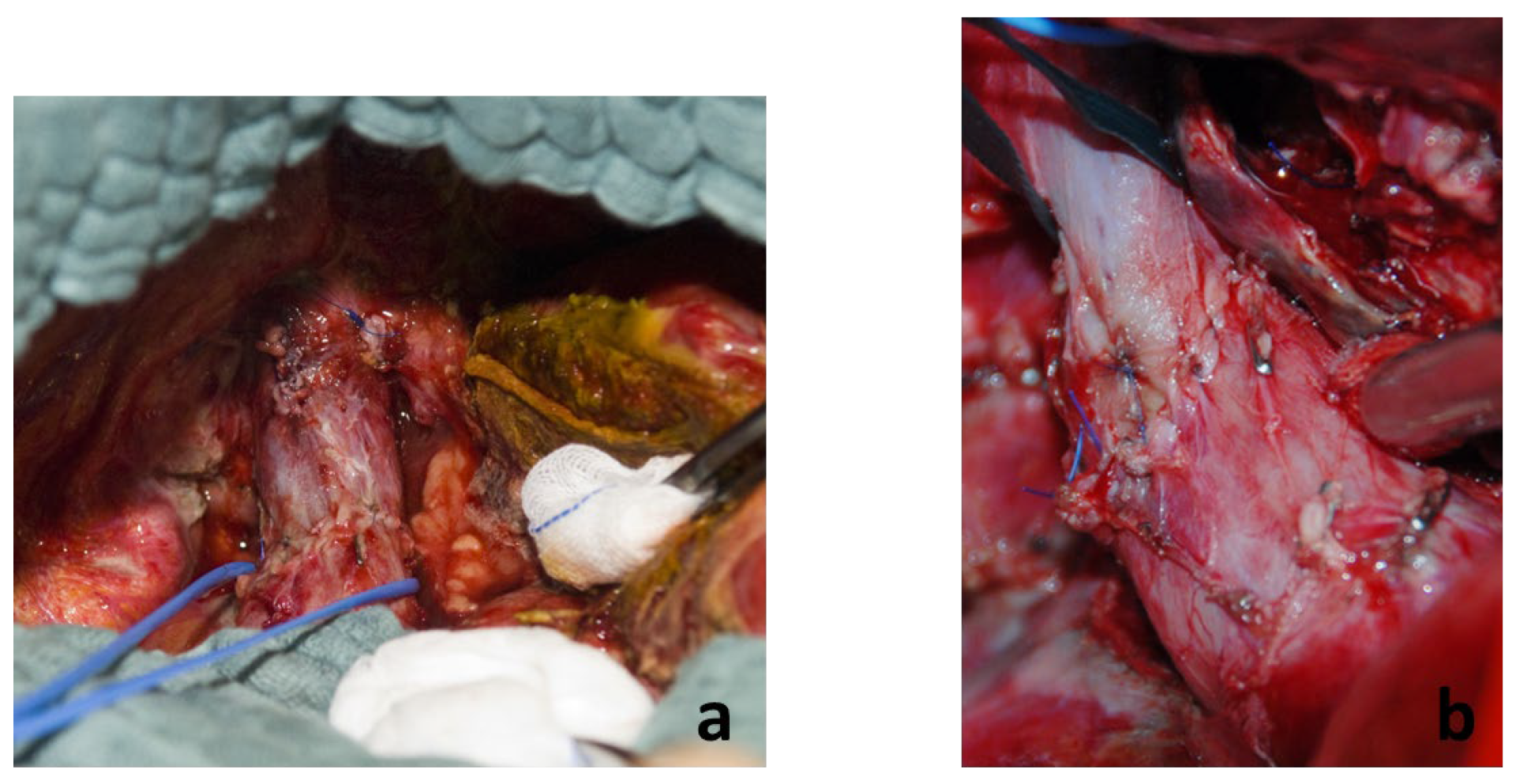 Cancers 16 00571 g004 Cancers 16 00571 g004