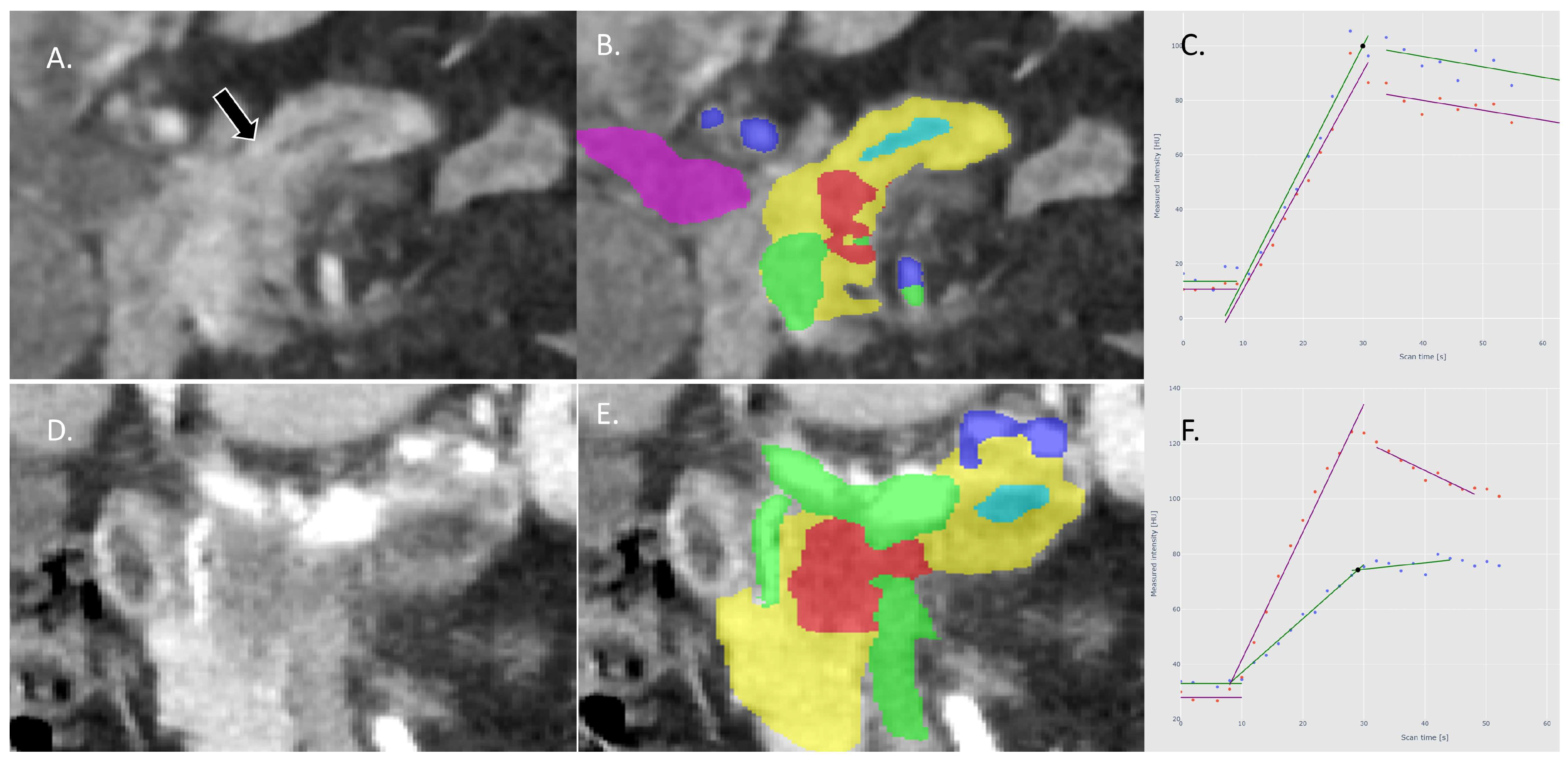 Cancers 16 00577 g003