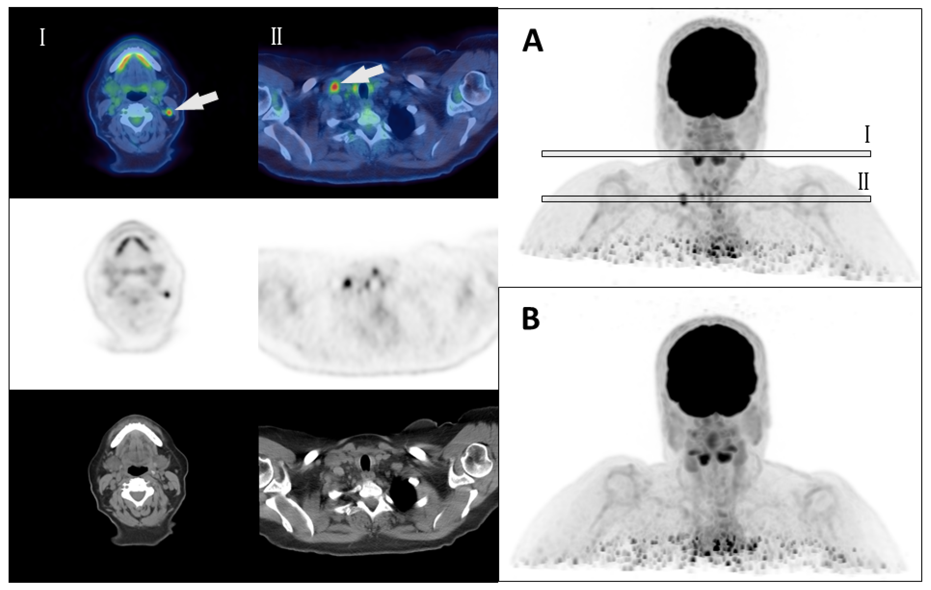 Cancers 16 00588 g003