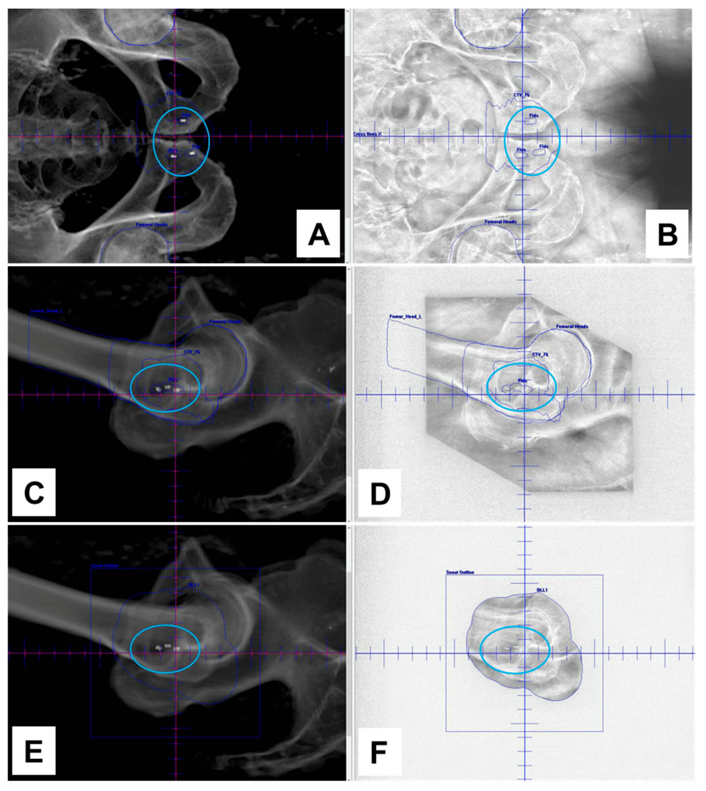 Cancers 16 00625 g002