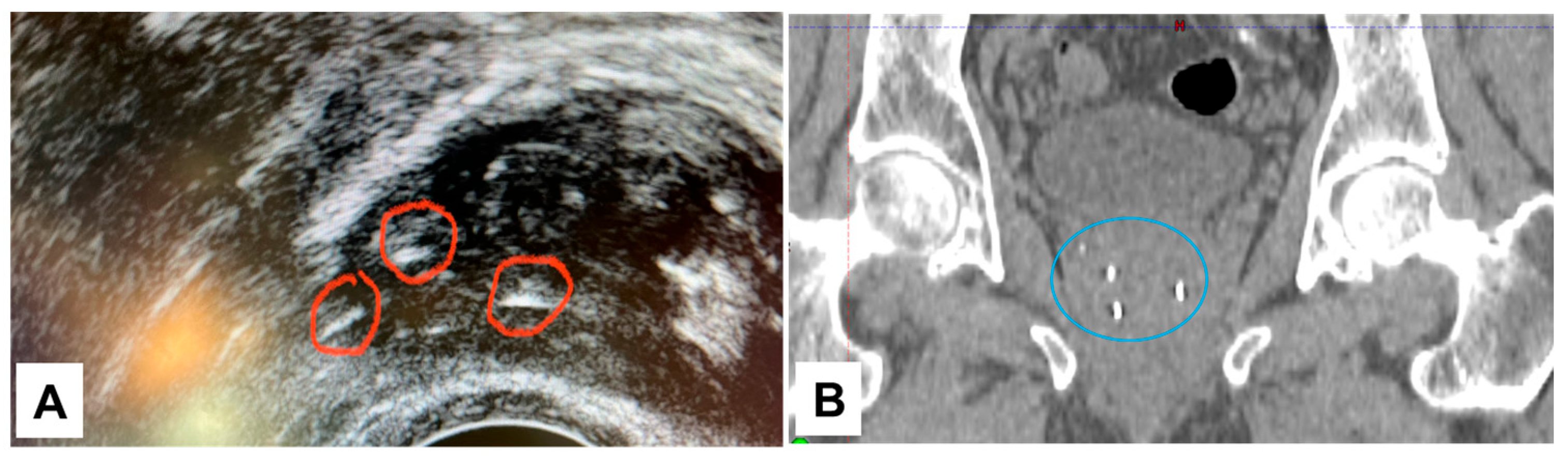 Cancers 16 00625 g003