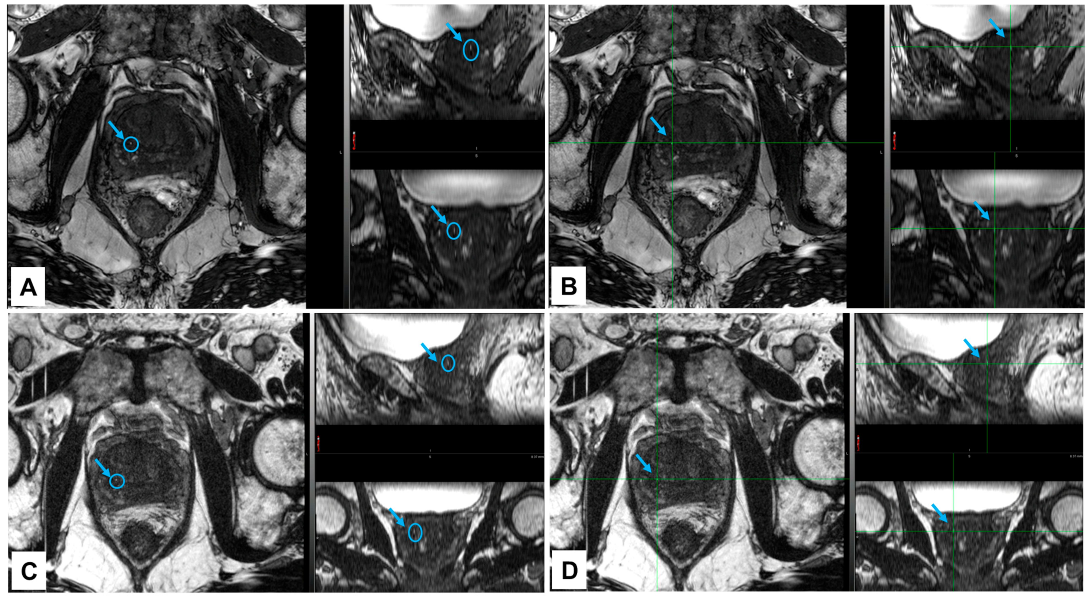 Cancers 16 00625 g004