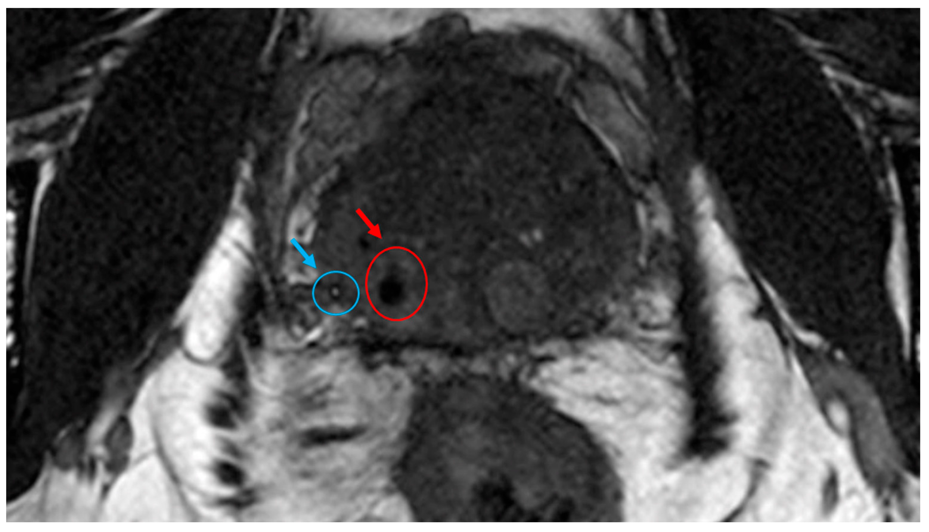 Cancers 16 00625 g005