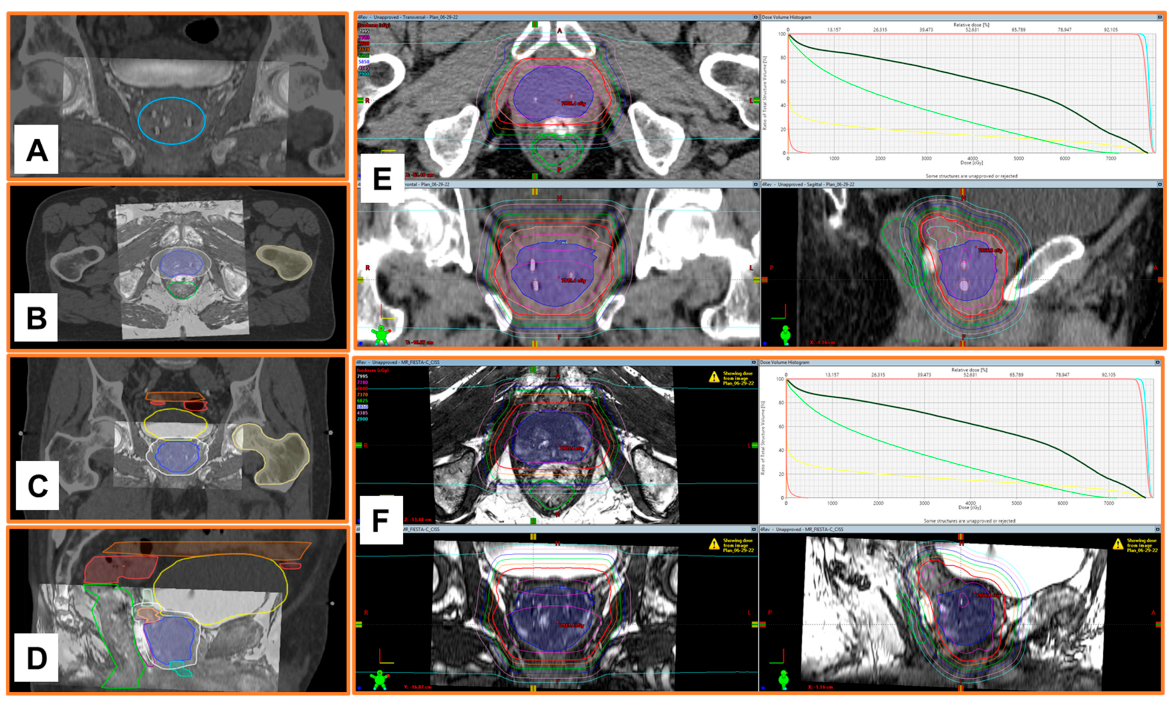 Cancers 16 00625 g006